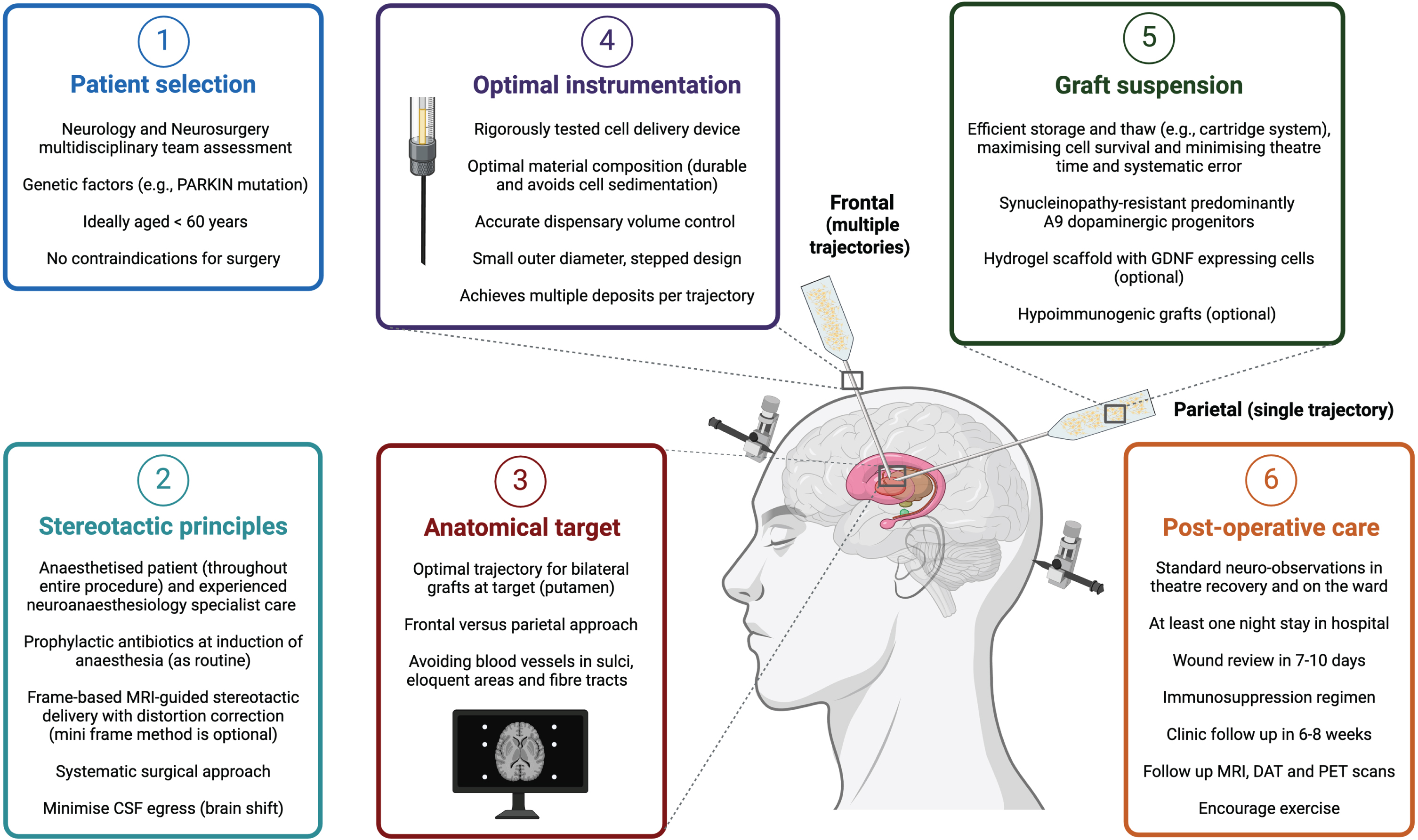 Optimizing neurosurgical delivery in an ideal cell replacement therapy paradigm for Parkinson’s disease.