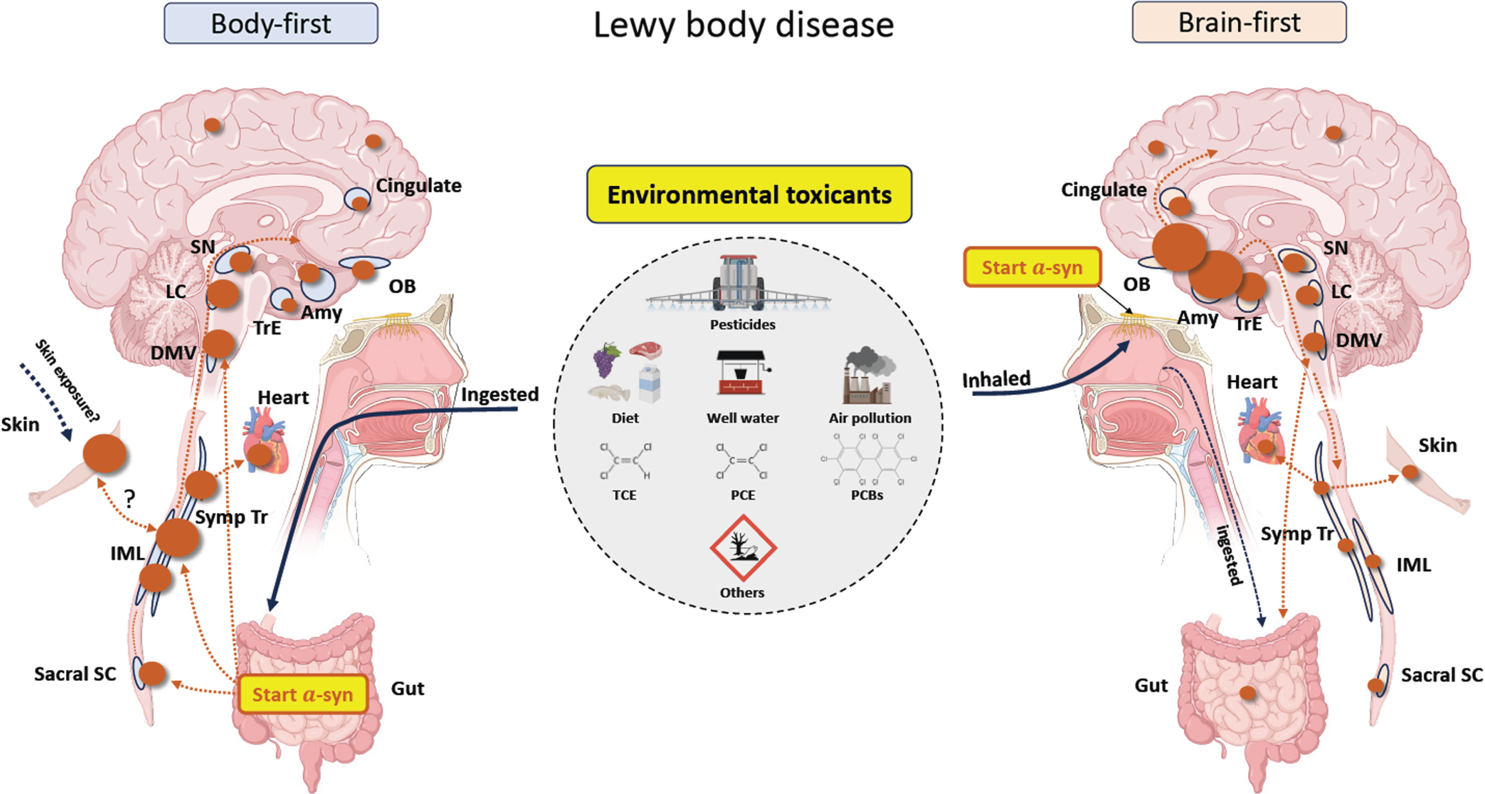 A proposal on how environmental exposure to toxicants may cause either body-first or brain-first Lewy body disease. The size of the brown circles reflects the amount of Lewy pathology in each region. In body-first Lewy body disease, toxicants are most likely ingested through diet and drinking water, but swallowing inhaled toxicants trapped in mucous is also a possibility. In the gut, the toxicants trigger initial a-synuclein misfolding in the enteric nervous system, which then spread centripetally towards the central nervous system via parasympathetic and sympathetic neurons. Consequently, a-synuclein in the peripheral autonomic nervous system and brainstem will be dominating, and less pathology will be found in more rostral structures. The skin could be an alternative trigger site for body-first Lewy body disease. In brain-first Lewy body disease, inhaled toxicants may trigger initial pathology in the olfactory bulb, with subsequent spread to closely related structures. Consequently, a-synuclein in amygdala and olfactory-related structures such as the transentorhinal cortex display most pathology, and less will be found in the brainstem and peripheral autonomic nervous system. Sacral SC, sacral spinal cord; IML, intermediolateral column; Symp Tr, sympathetic trunk; DMV, dorsal motor nucleus of vagus; LC, locus coeruleus; SN, substantia nigra; Amy, amygdala; OB, olfactory bulb; TrE, transentorhinal cortex; PCBs, polychlorinated biphenyls; TCE, trichloroethylene; PCE, perchloroethylene.
