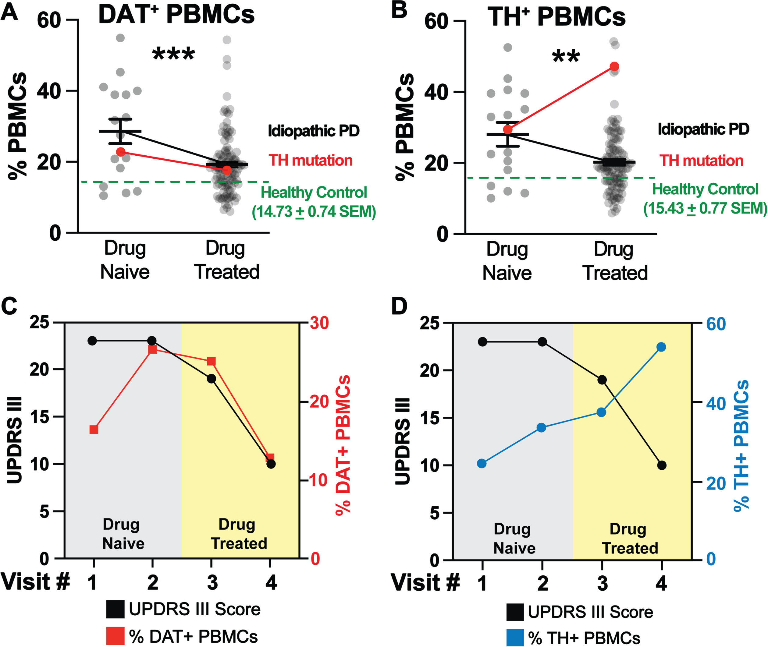 DAT+ and TH+ PBMCs are increased in idiopathic PD patients at the time of diagnosis and decreased following improved UPDRS-III scores as a consequence of L-DOPA/Carbidopa treatment. By contrast, unlike the DAT+ PBMCs, in a patient carrying a TH mutation, the TH+ PBMCs remains elevated even after successful pharmacotherapy, representing an uncoupled response to L-DOPA/Carbidopa treatment. Single cells, free from debris, were analyzed via flow cytometry for expression of DAT and TH (Supplementary Figure 2). A-B) DAT+ and TH+ PBMCs (grey dots) are increased in drug naïve idiopathic PD patients (n = 16) relative to healthy controls (n = 80, green dashed line). These markers are reduced significantly in drug treated idiopathic PD patients (n = 114), though remaining significantly higher than age/sex matched healthy control levels (***p < 0.001; t,df(3.763, 128), **p < 0.01; t,df(3.138, 128), unpaired Student’s t-test with Tukey’s correction, alpha = 0.05). In the PD patient carrying a single pathogenic TH mutation (red line), A) the pattern of DAT+ PBMCs change follows the pattern we identified in idiopathic PD patients, i.e., increased at the time of PD diagnosis (drug naïve condition) and then decreasing following successful L-DOPA/Carbidopa treatment. However, B) TH+ PBMCs of the PD patient carrying pathogenic TH mutation are uncoupled from both DAT+ PBMCs and the predicted reduction following L-DOPA/Carbidopa treatment, for instance, they are elevated in the drug naïve condition and continue to increase despite improved UPDRS-III, as a results of L-DOPA/Carbidopa treatment. C) Similar to idiopathic PD patients, the PD patient carrying pathogenic TH mutation, DAT+ PBMCs (red line) are elevated at the first visit (drug naïve) and remain elevated as a function of impaired motor function (UPDRS-III, black line). Once L-DOPA/Carbidopa treatment is initiated, both DAT+ PBMCs and UPDRS-III scores decrease, indicating positive response to pharmacotherapy. D) In the PD patient carrying pathogenic TH mutation, the TH+ PBMCs (blue line) are increased following worsening motor symptoms (UPDRS-III, black line), but TH+ PBMCs continue to rise despite positive response to L-DOPA/Carbidopa (indicated by decreasing UPDRS-III motor scores), suggesting in this patient, only changes in the DAT+ PBMCs are coupled to both worsening motor function and positive L-DOPA/Carbidopa treatment response.