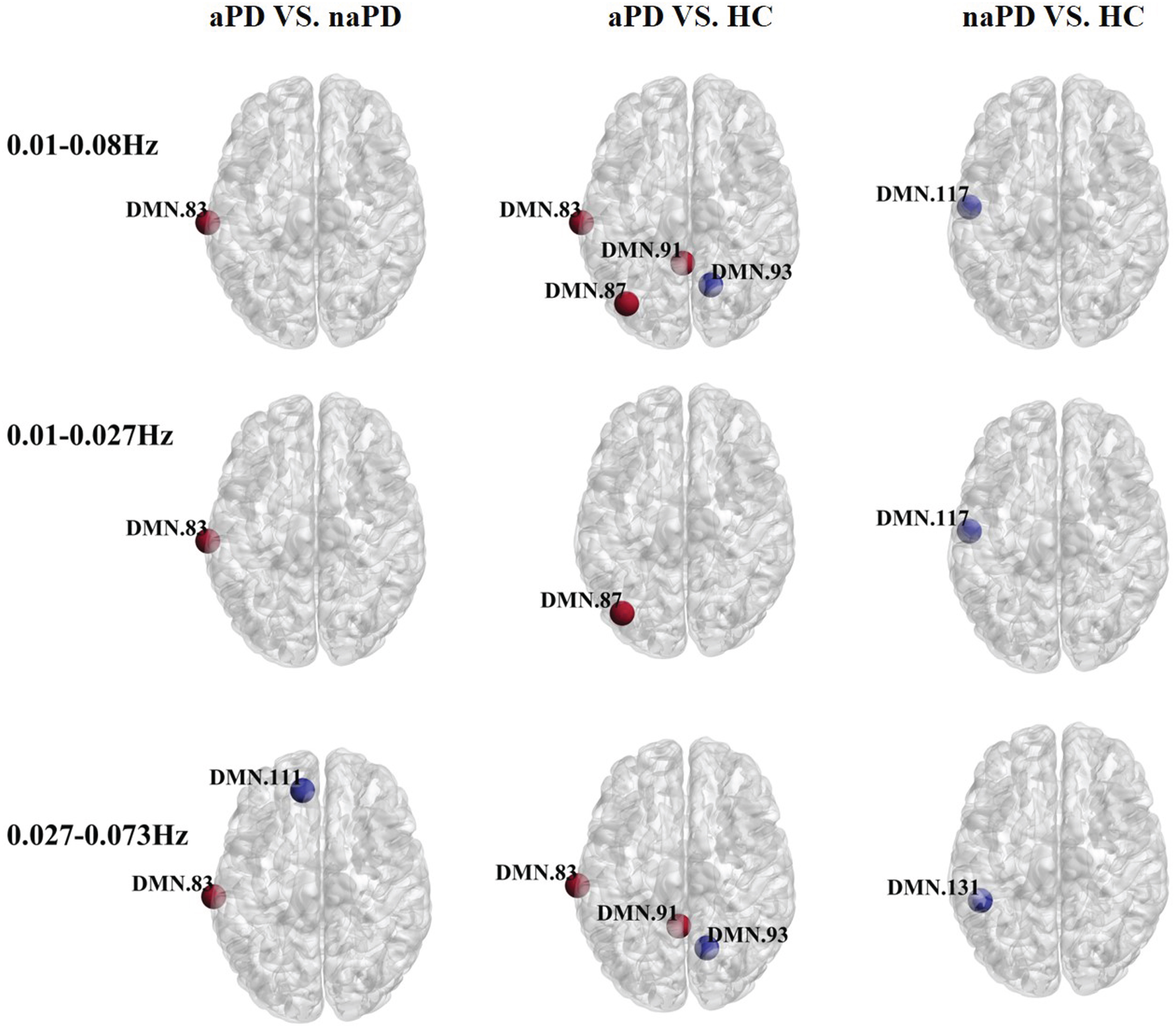 Oscillation-specific alterations of nodal efficiency in PD with or without anxiety. Red nodes suggest an increase in efficiency and blue nodes suggest a decrease in efficiency.