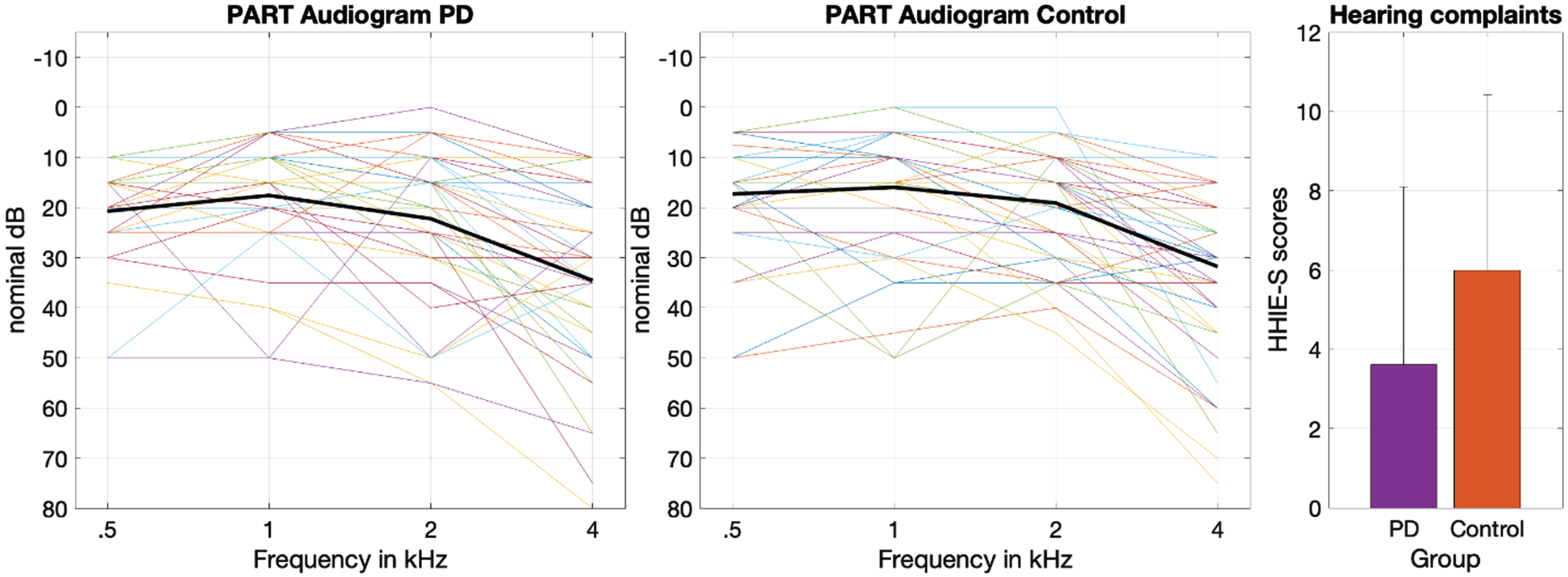 Left and middle panels show pure tone detection thresholds across the four frequencies tested in each group. The solid black line represents the mean detection threshold. The right panel shows the mean self-reported hearing loss in each group. The error bars represent the standard deviation.