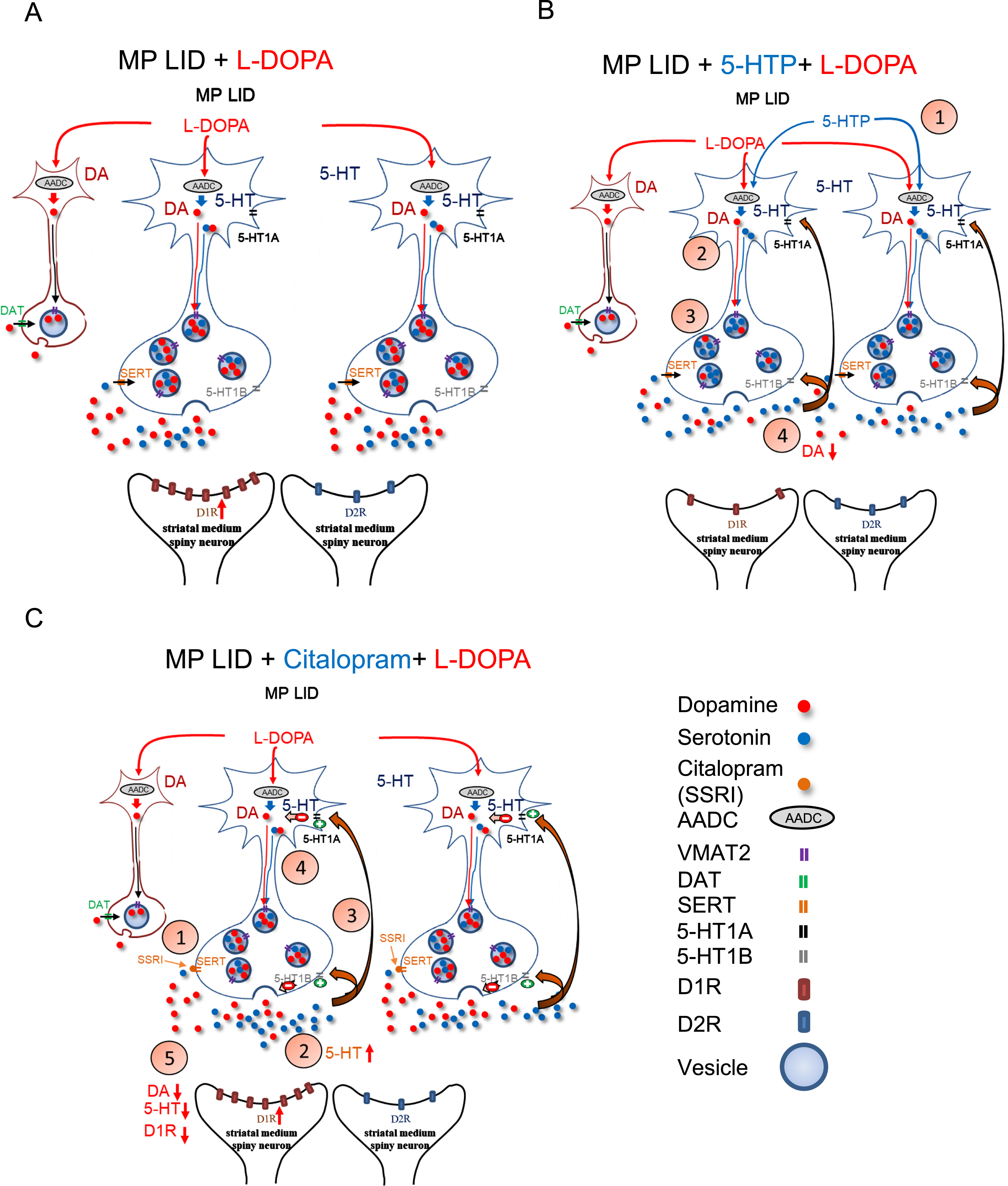 Graphical illustration delineates the effects of 5-HTP and Citalopram on DA release induced by the administration of L-DOPA in MP LID mice. A) The administration of L-DOPA induces aberrant release of DA in the synaptic cleft. The release of L-DOPA-derived DA may be regulated by the 5-HT neurons. B) Through the administration of 5-HTP, which competes with L-DOPA for AADC, the amount of DA in synaptic vesicles is reduced, thereby partially normalizing the abnormal DA levels in the synaptic cleft. Moreover, 5-HTP-derived 5-HT could activate 5-HT1 receptors, subsequently downregulating serotonin neuron-derived DA release in the DA-denervated striatum. C) Citalopram, by inhibiting SERT activity, may impede the reuptake of DA into presynaptic serotonin neurons, which attenuates the L-DOPA-induced aberrant DA release in the DA-denervated striatum. In addition, Citalopram administration increases serotonin concentration in the synaptic cleft by inhibiting SERT reuptake. Subsequently, excess 5-HT activates 5-HT1 receptors, subsequently inhibiting 5-HT neuron activity and reducing serotonin neuron-derived DA release after L-DOPA administration.