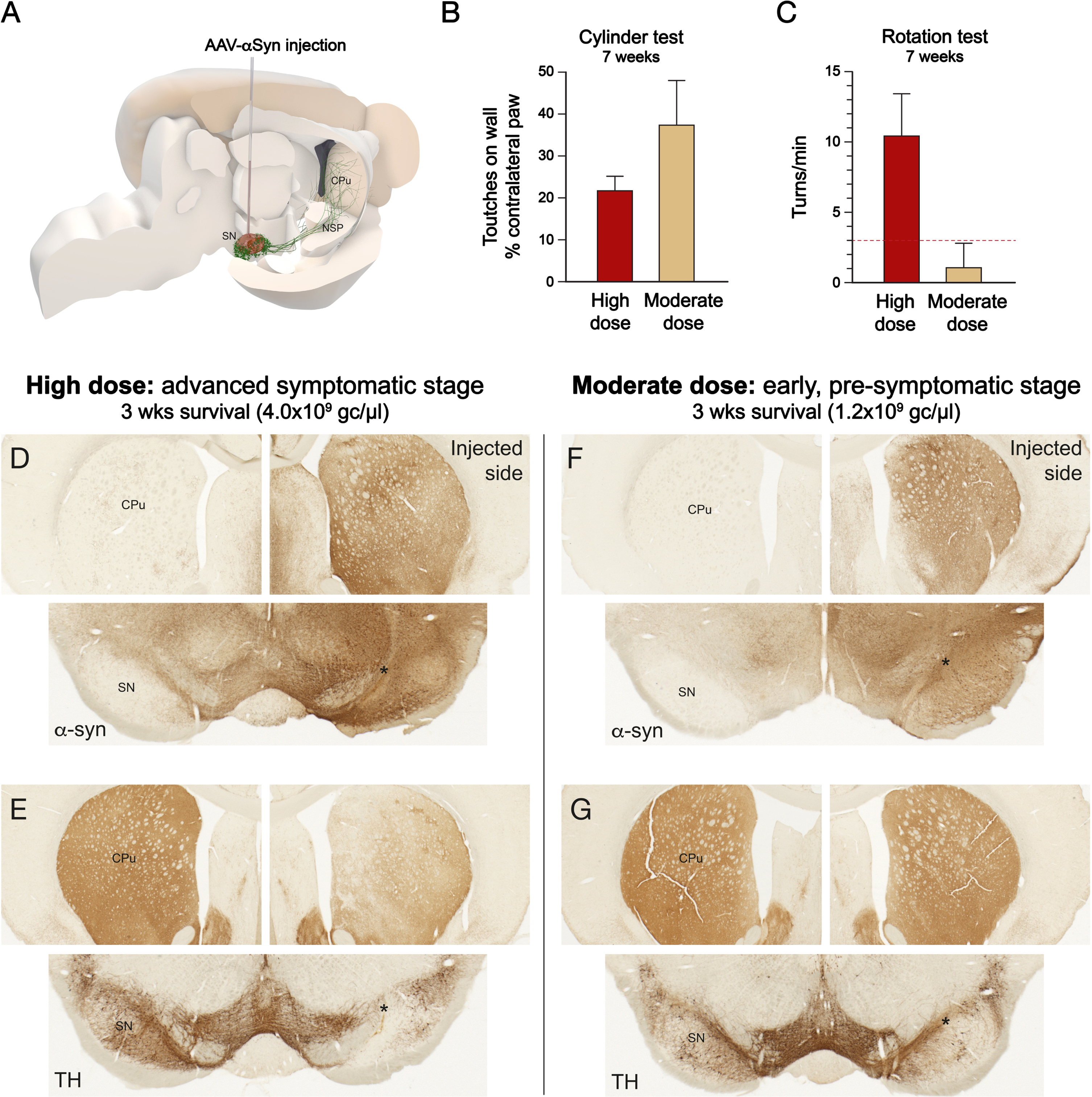 Selection of vector dose for the pre-symptomatic and advanced, symptomatic versions of the intranigral AAV-α-synuclein model, induced by a single, unilateral injection into the substantia nigra (A). A high vector dose is required to induce neurodegenerative pathology associated with a significant impairment in paw use and amphetamine-induced turning, as determined in this case at 7 weeks post-injection (B,C). At this dose the vector-derived human α-synuclein is expressed at a high level throughout substantia nigra (SN), along the axons in the nigrostriatal pathway (NSP) and in the terminals in the caudate-putamen (CPu) (D), and it induces already at 3-4 weeks a loss of at least 25–30% of the TH+ nigral neurons, and a corresponding loss of TH+ innervation in the striatum (E). At the moderate, 3-fold lower dose, TH+ cell number and TH+ striatal innervation is unaffected, or at most marginally reduced (at most 20–25%) when assessed at 3 weeks post-injection (G). TH+ cell loss may develop at longer survival times, 12–24 weeks, but the animals remain essentially non-symptomatic at shorter survival times (B,C). Importantly, to match the requirements for a prodromal level of synuclein pathology the vector-derived α-synuclein should cover a large part of the substantia nigra and be expressed at high level in the striatal terminals, most importantly in the motor-related dorsolateral part of the head of the caudate-putamen (F). Dashed line in C represents the threshold rate, 3 turns/min, commonly used to signify a significant motor impairment in the amphetamine rotation test. (Own original data).