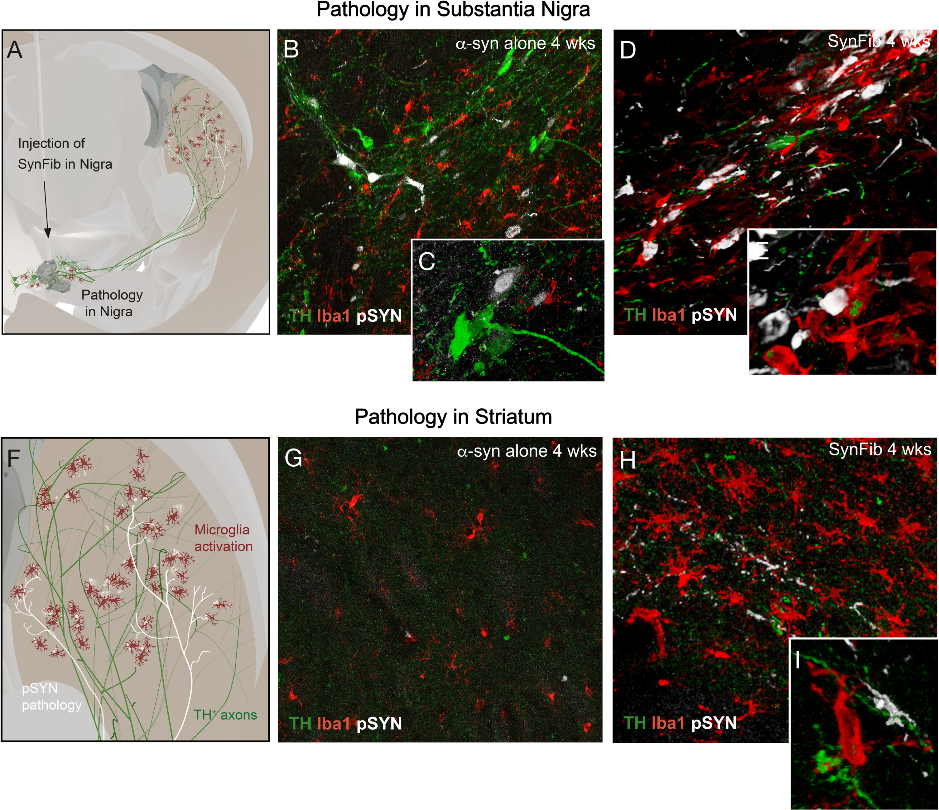 In the SynFib model where the AAV-α-synuclein vector is used in combination with pre-formed fibrils (PFFs) the PFFs act as seeds to accelerate and amplify the formation of toxic α-synuclein aggregates. The vector is used at a moderate dose level to induce early-stage, non-symptomatic DA neuron pathology when the vector is used alone, as illustrated in panels D and E in Fig. 1, combined with a dose of human PFFs that, by itself, is not able to induce DA neuron loss at shorter survival times (B,G). The development of pS129-α-synuclein (p-syn) pathology and microglial activation (A,F) is enhanced and accelerated, both in nigra (D,E) and striatum (H,I) and is observed already at 4 weeks post-injection. (Own original data).