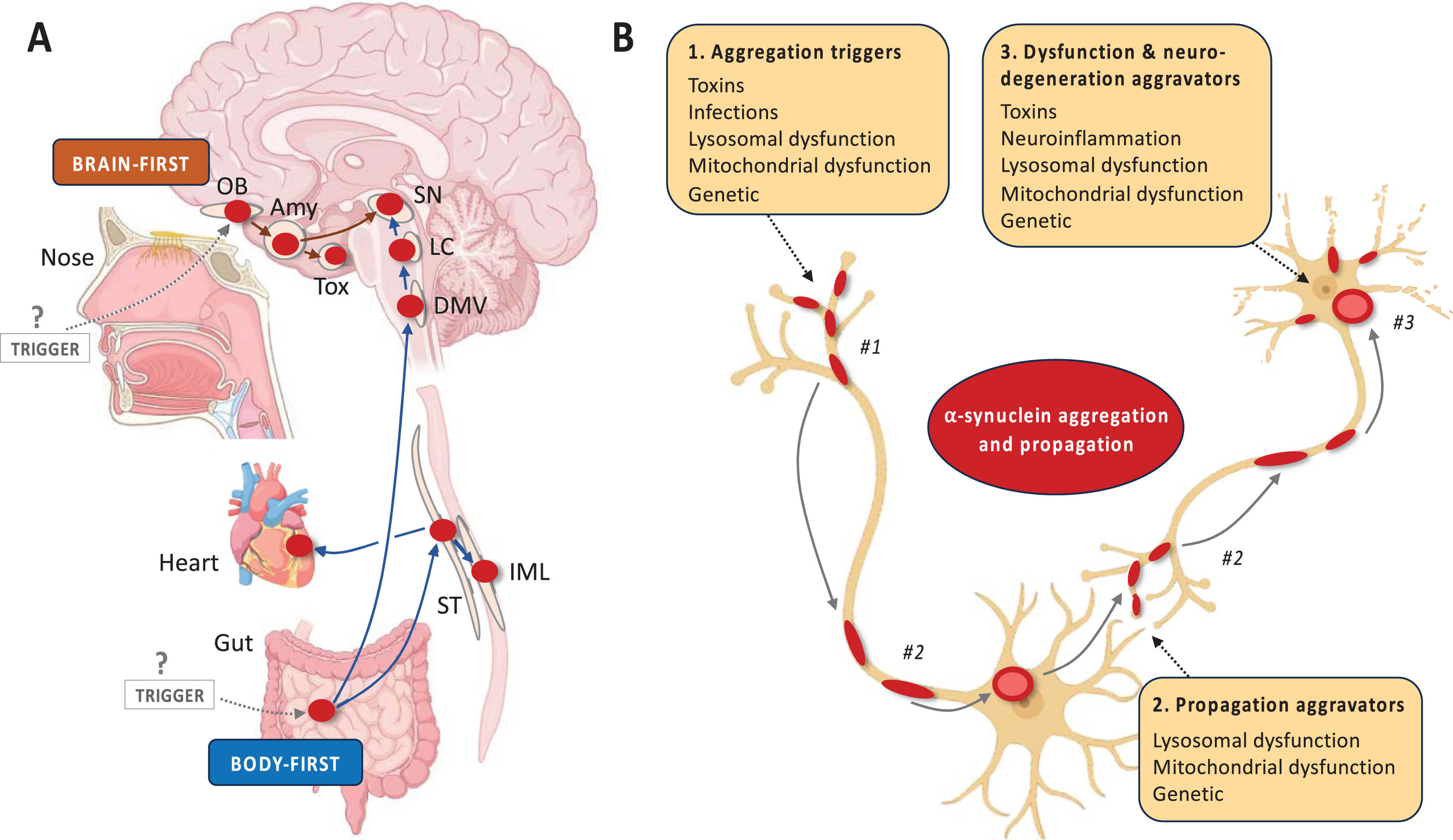 A priori disease modelling exemplified by brain- vs. body-first Lewy body disease. Figure 2 (A) A priori disease modelling exemplified by the brain-first vs. body-first model of Lewy body disease.64 This model posits that (i) α-synuclein aggregation starts in a single place in most patients and propagates from there. (ii) The two most probable origin sites are the olfactory epithelium (brain-first) and gastro-intestinal nervous system (body-first). (iii) Propagating α-synuclein pathology thereby leads to two overarching clinical types of Lewy body disease. Body-first cases typically develop dysautonomia and RBD before a relatively symmetric dopamine degeneration occurs. In contrast, brain-first cases often develop more asymmetric dopamine loss, have a shorter prodromal phase, and display few non-motor symptoms at diagnosis. (iv) Histologically, early body-first cases display Lewy pathology mainly in the autonomic system and brainstem, whereas early brain-first cases exhibit pathology mainly restricted to the olfactory bulb and limbic system. (v) With time, the two types converge on a common end-stage phenotype characterized by widespread peripheral and central pathology, parkinsonism, non-motor symptoms including RBD, and dementia. (B) The brain- vs. body-first model proposes that α-synuclein aggregation and propagation is the core pathogenic feature but acknowledges that many other pathogenic factors are important to the pathogenesis of Lewy body disease. The panel shows a non-exhaustive list of potential factors, which may (i) trigger the aggregation of α-synuclein in the first place or allow it to be triggered, (ii) facilitate the propagation of α-synuclein aggregates through the nervous system, and (iii) increase the vulnerability of neurons to the presence of α-synuclein pathology leading to neuronal dysfunction and eventually degeneration. Amy, amygdala; DMV, dorsal motor nucleus of vagus; IML, intermediolateral column; LC, locus coeruleus; OB, olfactory bulb; SN, substantia nigra; ST, sympathetic trunk; Tox, transentorhinal cortex.