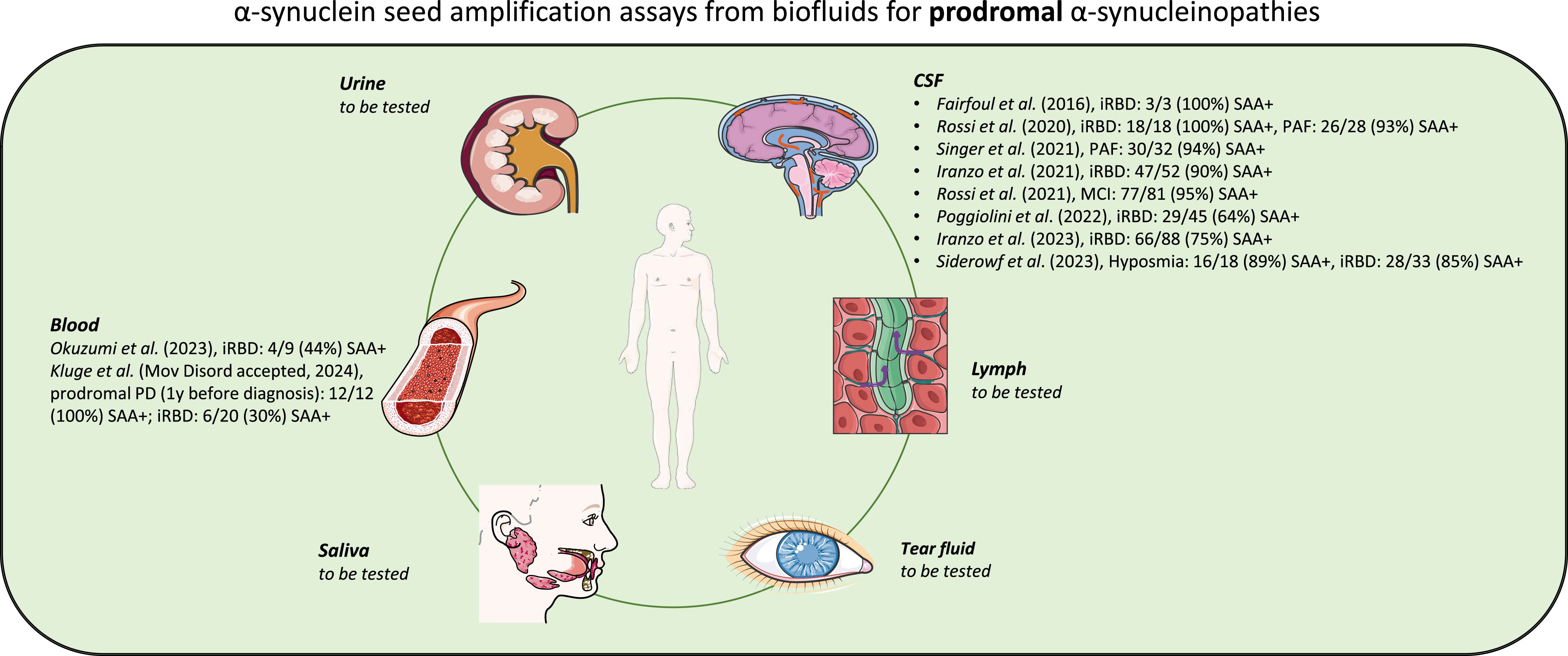 Schematic representation of α-syn SAAs from biofluids for prodromal α-synucleinopathies. Illustration was created using Smart Servier Medical Art (http://smart.servier.com/), which is licensed under CC BY 3.0.