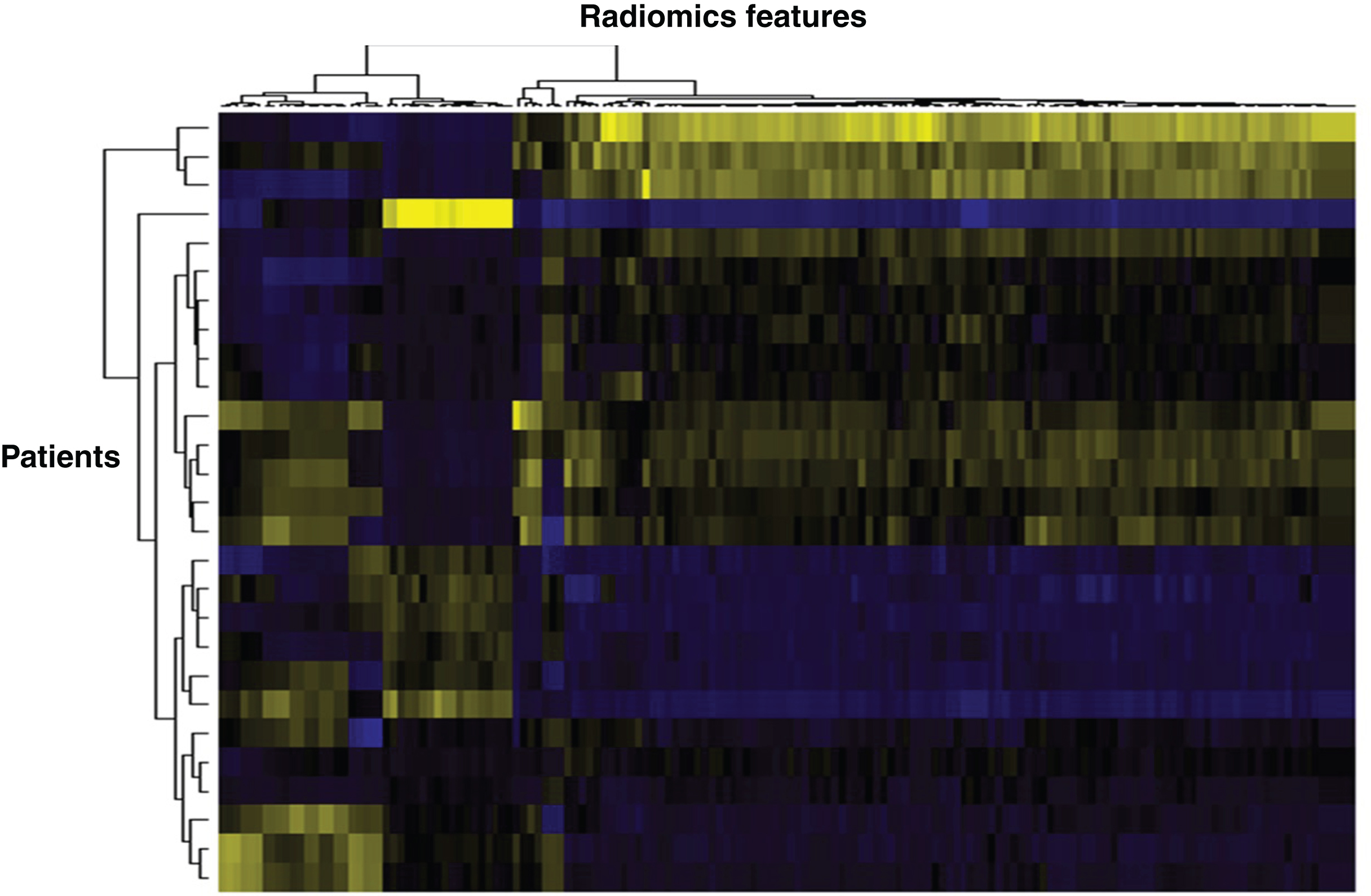 Heat map based on radiomics features extracted from mRCC patients. Vertically is represented each patient, horizontally each radiomics feature. Such heat maps allow separating patients according to common radiomics profiles, which are then correlated to a given outcome.