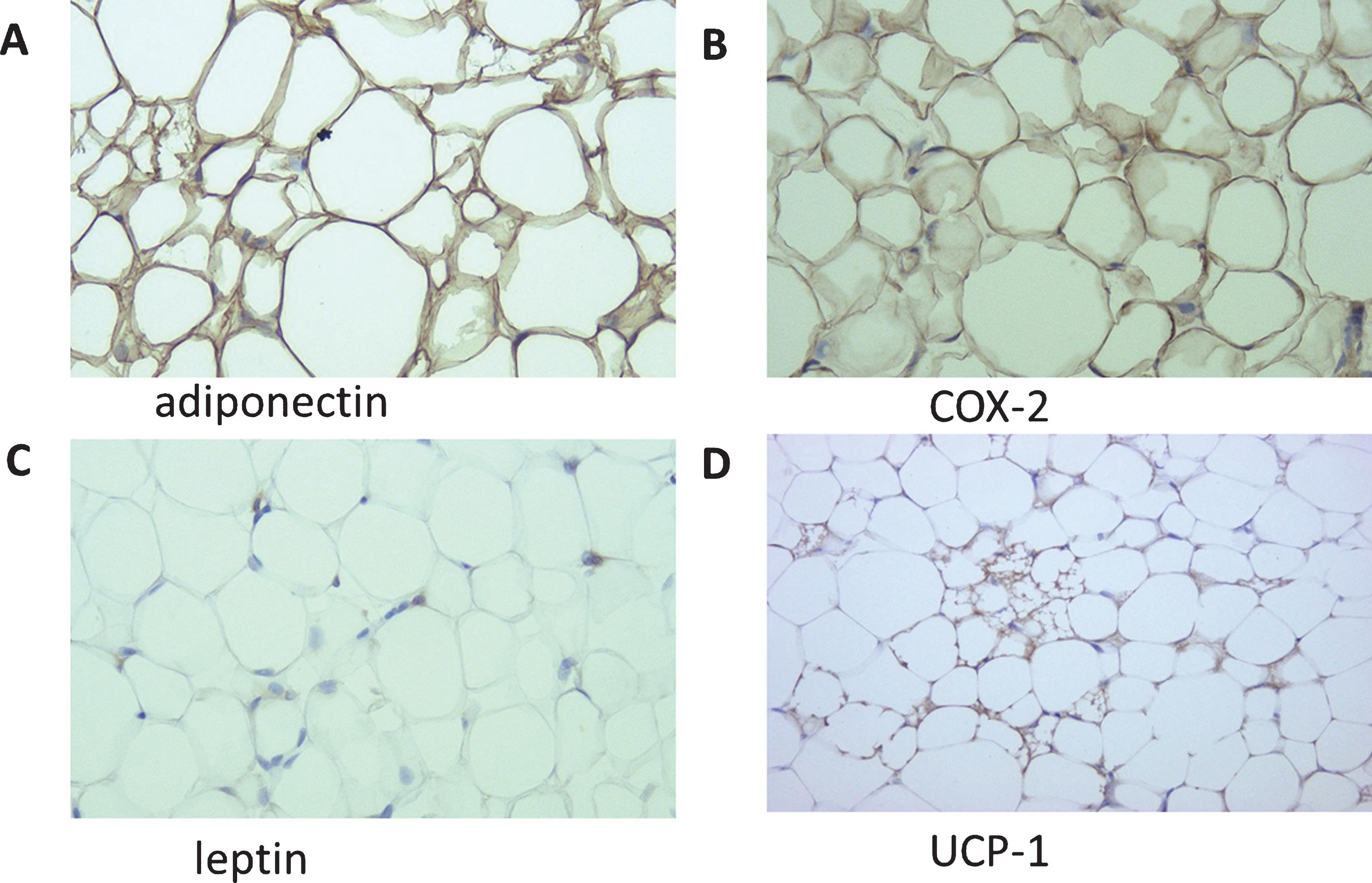 Immunohistochemistry of adiponectin (A), COX-2 (B), leptin (C), and UCP1 (D) in perirenal fat (original magnification: 200×).