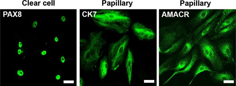 Primary cultures from PDX maintain RCC characteristics. Immunofluorescence of representative cell cultures of clear cell and papillary cases expressing PAX8, CK7 and AMACR, respectively. Calibration bars = 50μm.