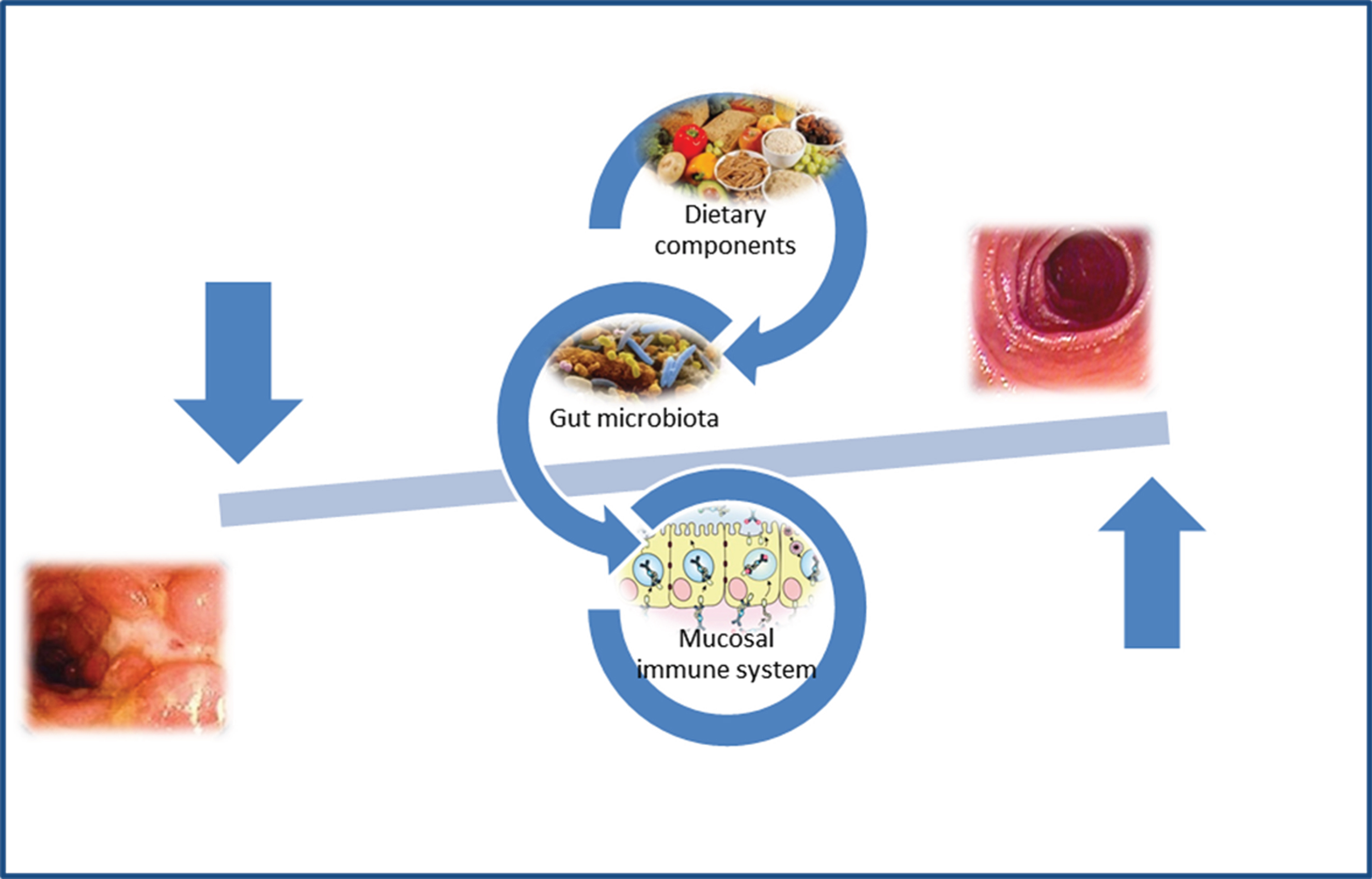 Gut microbiota and pathogenesis of Crohn’s disease.
