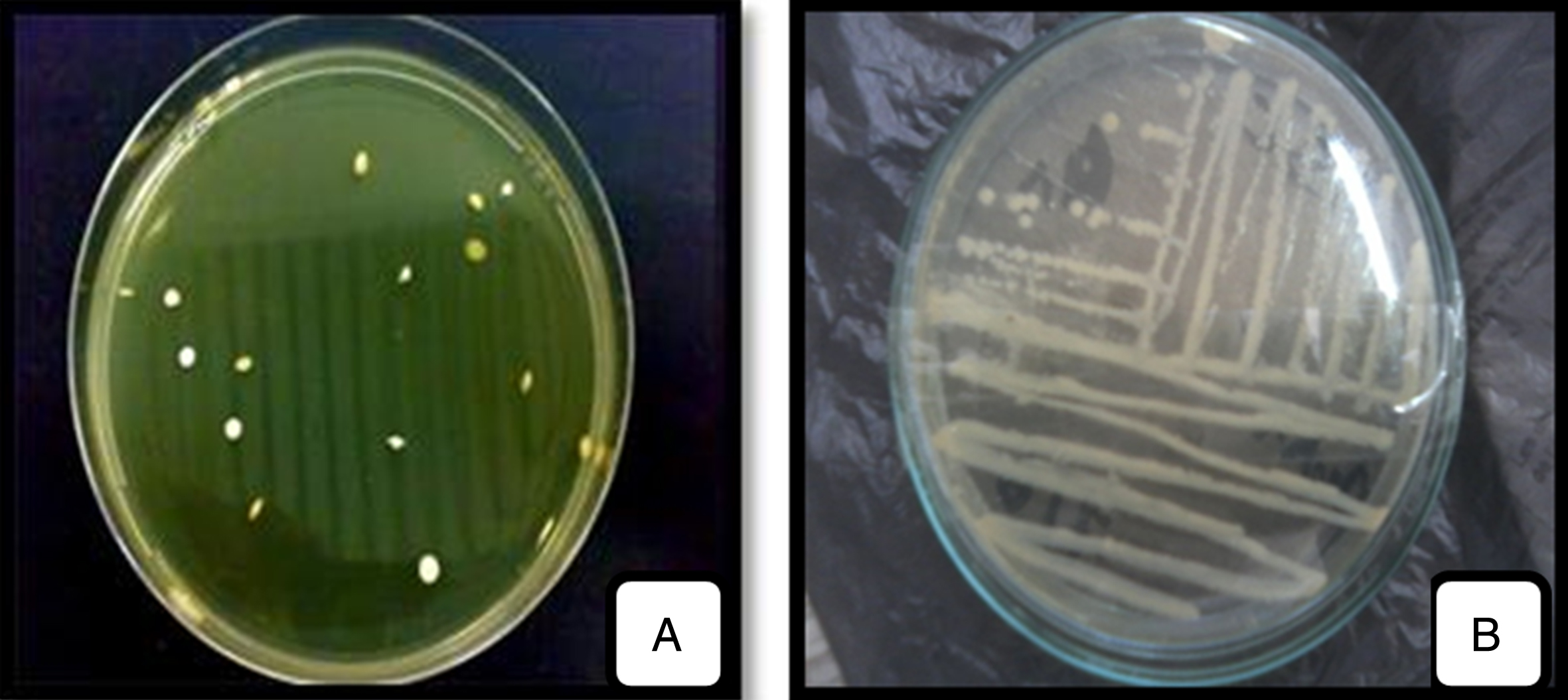 Macroscopic observation of LAB isolated (A) and purified (B) strains on Agar medium.