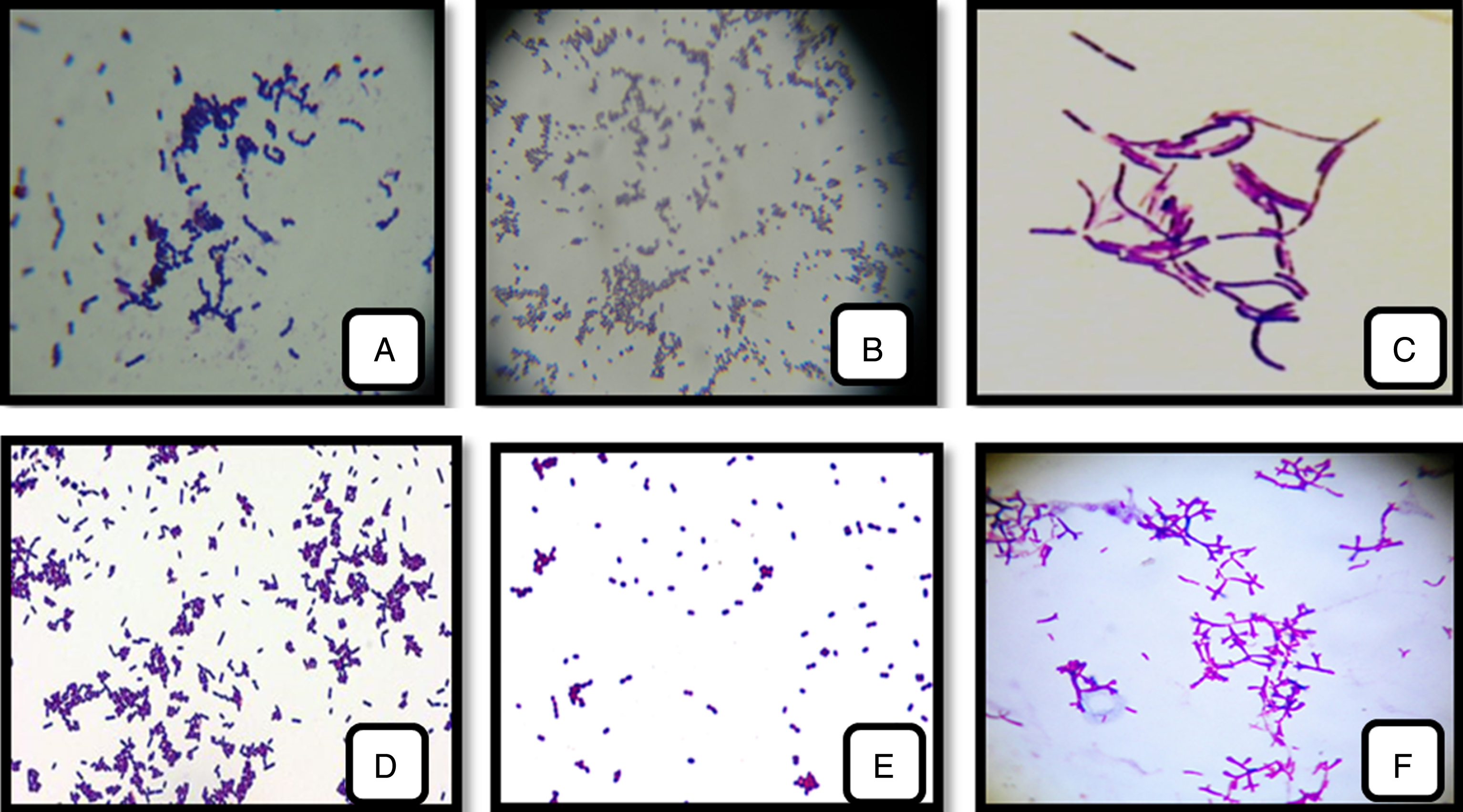 LAB and Bifidobacterium strains isolated from cow’s, camel’s-milk and infants feces. (A): Streptococcus thermophilus; (B): Pediococcus cerevisiae; (C): Lactobacillus bulgaricus;(D): Lactococcus lactis; (E): Enterococcus faecalis; (F): Bifidobacterium bifidum (1000 x).
