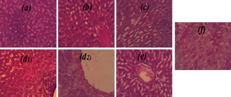 Effects of GTLAE on morphological features of rats’ livers during experiment. Hematoxylin eosin coloration. Optic microscopy; 40x magnification. At treatment cessation: (a) NG, (b) CHDG, (c) CG, (d2) PG; After treatment cessation: (d1) CHDG, (e) CG, (f) PG.