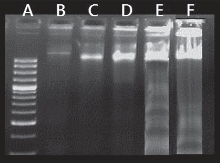 Agarose-gel-electrophoretic patterns showing DNA fragmentation of HepG2 cells. Lane (A): Represents the molecular marker. Lane (B): Control HepG2 cells. Lane (C) HepG2 cells treated with chloroform-methanol fraction. Lane (D): HepG2 cells treated with ethyl acetate fraction. Lane (E): HepG2 cells treated with honey. Lane (F): HepG2 cells treated with residue.