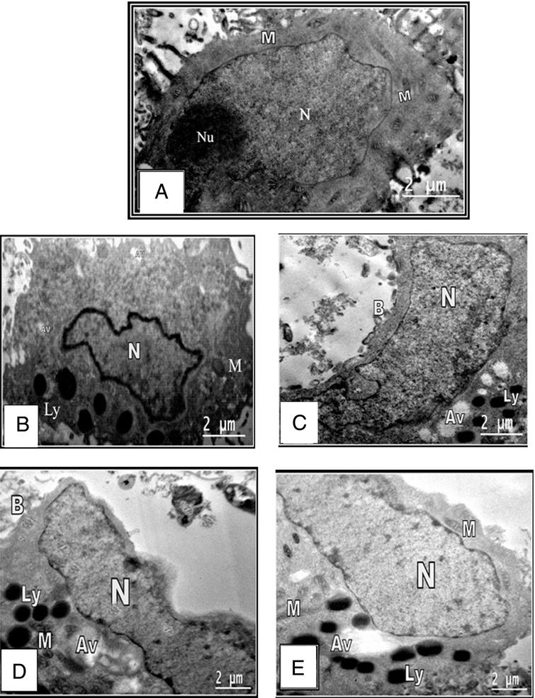 Transmission electron micrograph of HepG2 cell showing A: Marker. B: Control cells. C: Cells treated with honey. D: Cells treated with residue. E: Cells treated with ethyl acetate fraction. F: chloroform-methanol extract treated HepG2 cell. Large and irregular nucleus (N) nucleolus (Nu). Mitochondria with transverse cristae (M) Autophagic vacuoles (Av) osmophilic lysosomes (Ly).