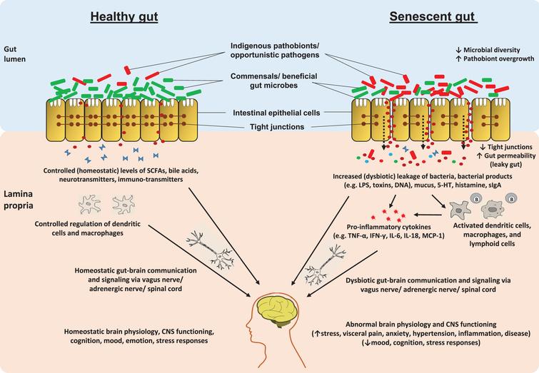 Schematic illustration of putative pathway(s) by which aging-related alterations in gut microbiome and entero-neuro-endocrine system may affect brain health via deteriorated gut-brain communication signaling. In healthy adult host, the balanced gut microbiome configuration and intestinal barrier integrity help in maintaining balanced arrays of microbes, microbial by-products (e.g. short-chain fatty acids; SCFAs) and other entities such as neurotransmitters across the gut wall thereby maintaining a balanced enteric-immune and -inflammatory system through controlled proliferation of dendritic cells and macrophages which eventually helps in keeping the gut-brain communication and the functioning of central nervous system (CNS) under control. In old age, the altered gut microbiota diversity and weakened gut barrier integrity may perturb the microbial and biochemical environment across the intestinal epithelial cell lining via abnormal levels of SCFAs, lipopolysaccharide (LPS), secretory Immunoglobulin A (sIgA), histamins, serotonin (5-hydroxytryptamine; 5-HT), etc. thereby instigating an abnormal (hyper) inflammatory responses eventually affecting (disturbing) the gut-brain communication [84, 90, 93, 103, 104, 109, 112, 124, 158].