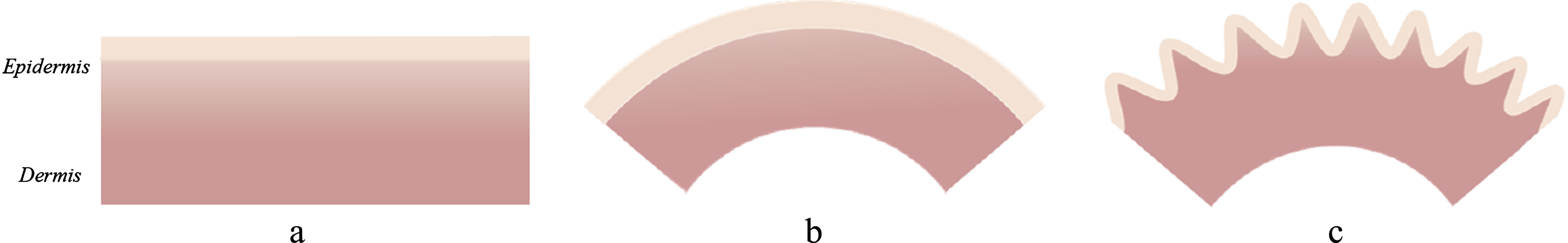 Wrinkling in the bi-layer skin model with bending: a – bi-layer composite epidermis/dermis; b – bending of this composite; c – wrinkling of the bended composite (modified after [55]).