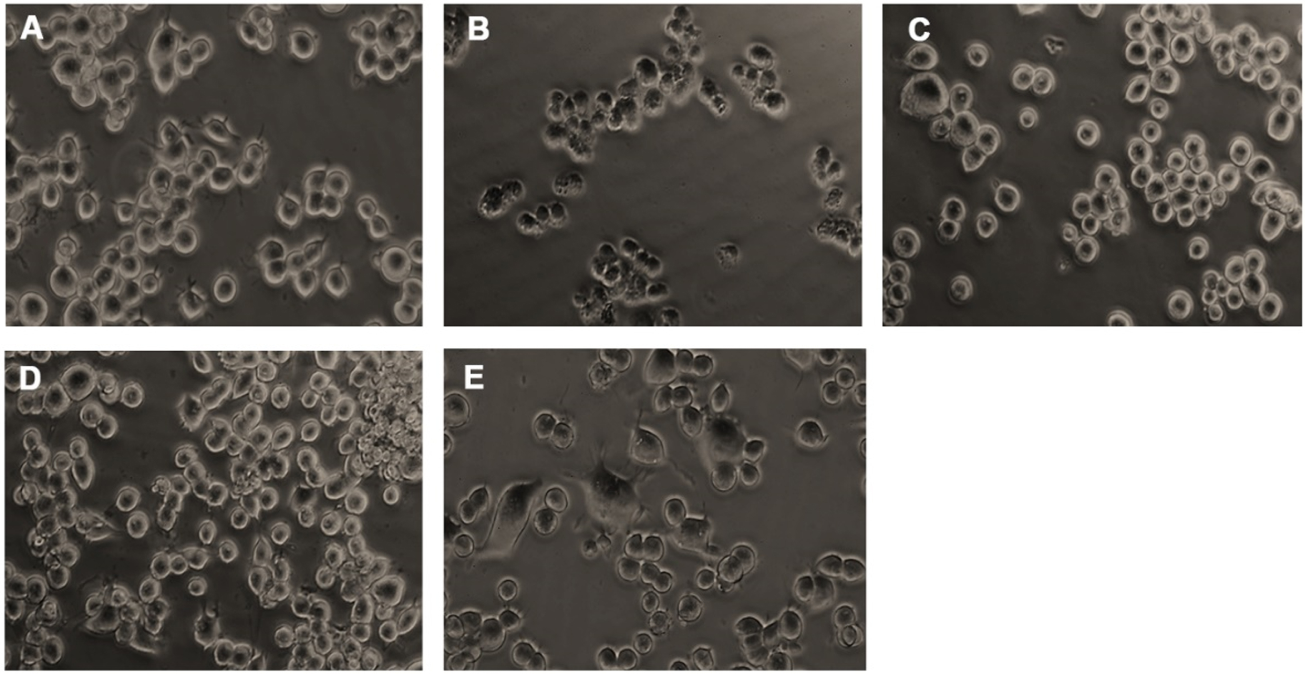 Microscopic images representing restoration from glucose-induced toxicity by HS. (A) Control (B) High glucose (175 mM) (C) HS-7.5 (pre-treatment 2 h) + high glucose (D) HS-10 (pre-treatment 2 h) + high glucose (E) HS-10