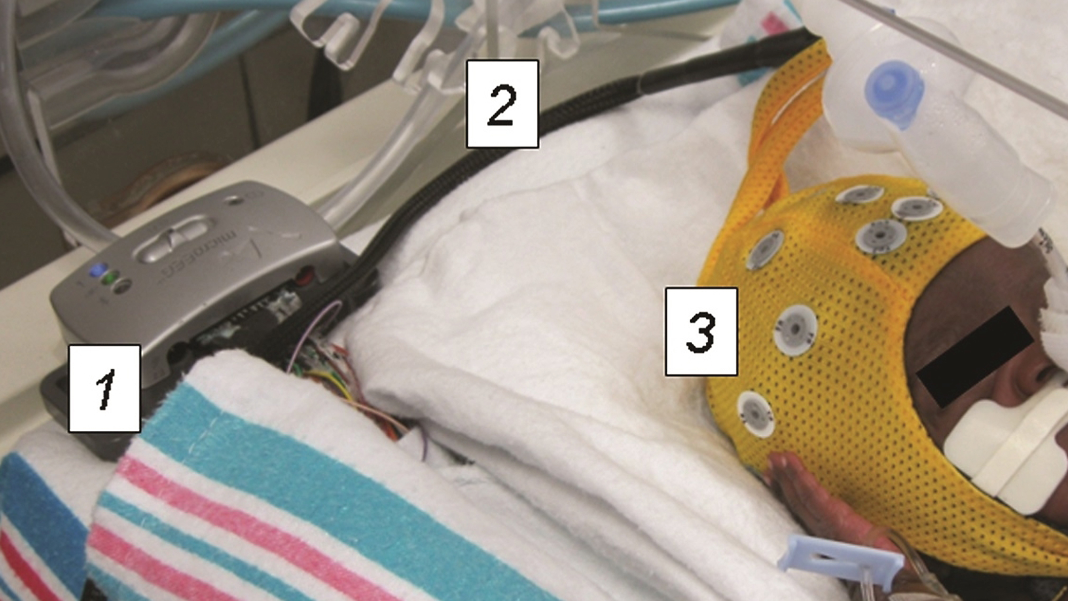 Preterm infant undergoing wireless EEG recording. The recording equipment is contained entirely within the isolette. The device transmits EEG recordings wirelessly to a bedside computer in real time. 1) Wireless EEG recording device 2) Connector cable 3) Electrode cap.