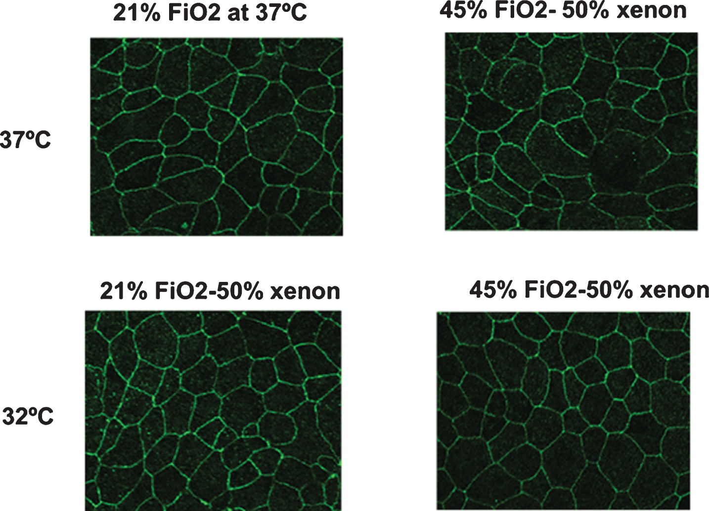 Representative tight junction images. Immunofluorescence localization of ZO-1 (XY) showed reduced density of the ZO-1 rings and the incomplete ring-like staining in the 45% FiO2-50% xenon group at 32°C compared with other groups. The intensity of the cytoplasm in this group was greater than that in the other groups.
