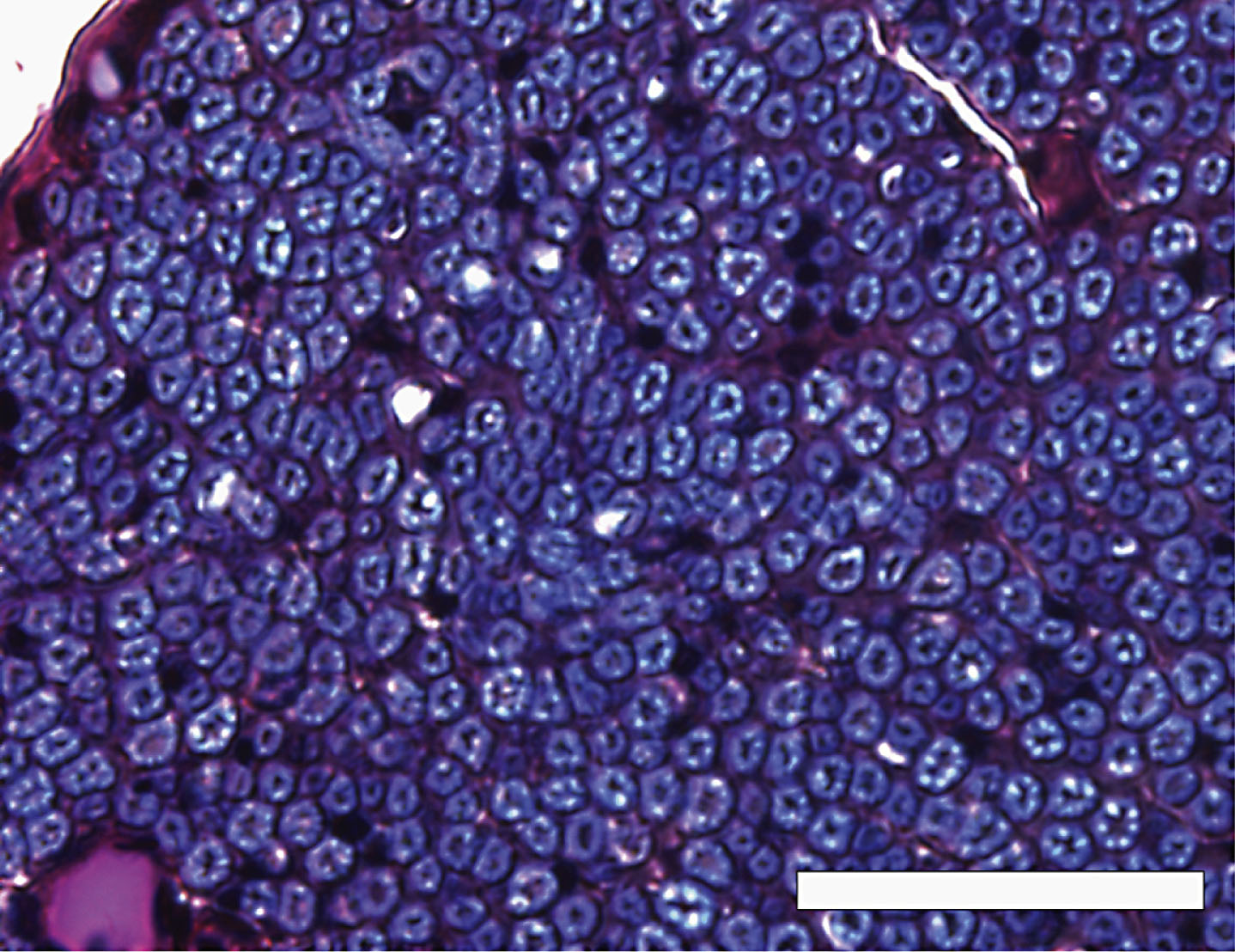 A high-power view of the inferior alveolar nerve from a 68-year-old man, modified luxol fast blue-periodic acid Schiff-hematoxylin triple stain. Axons were stained dark purple or black, and surrounded by a myelin sheath stained indigo blue. Scale bar = 50 μm.