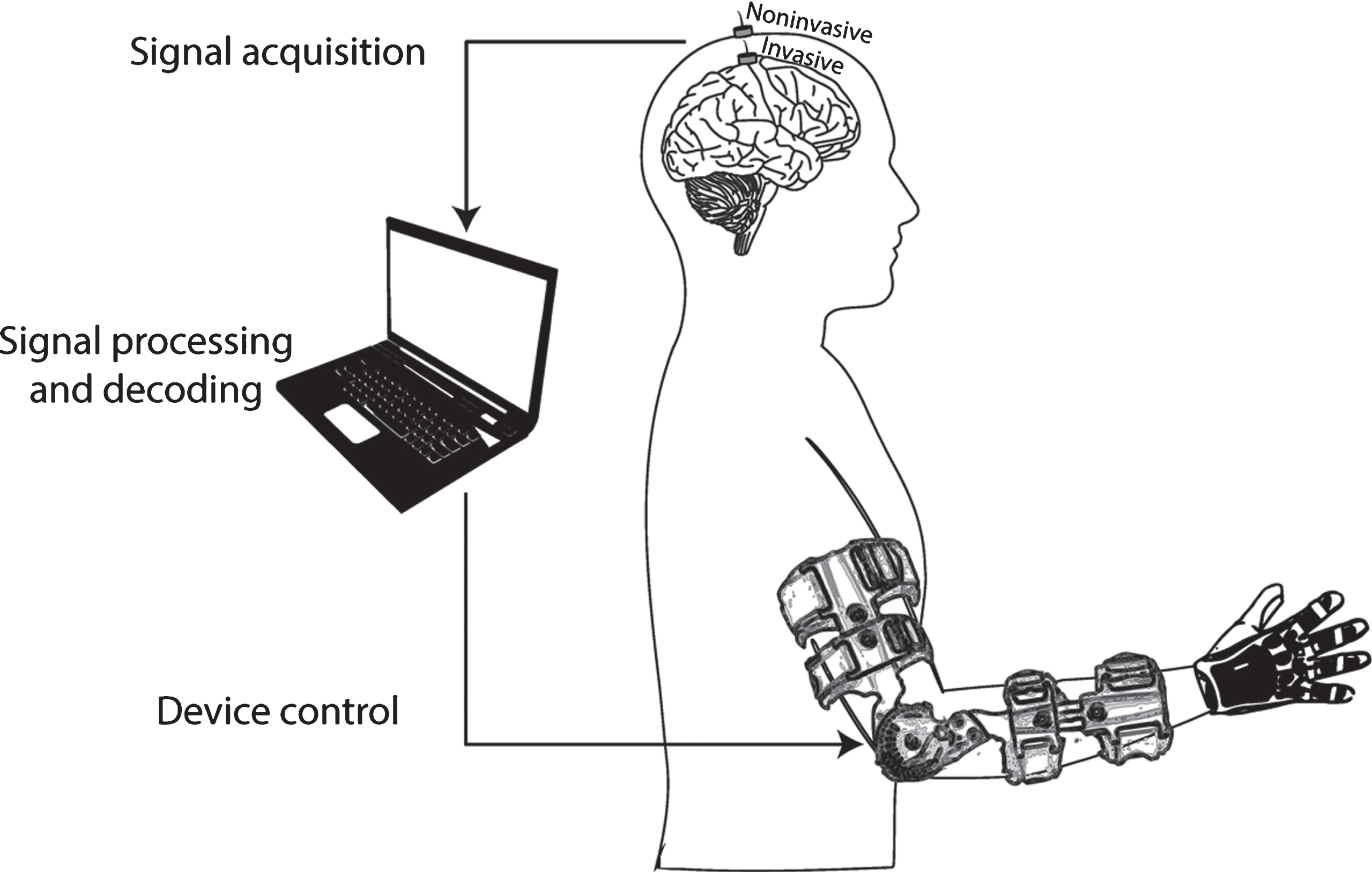 General diagram of a brain-machine interface for upper-limb motor rehabilitation. During the BMI therapy, the patient with upper-limb paralysis would be asked to imagine/attempt to move his/her paralyzed arm, and those intentions would be translated into the actual movement of the patient’s limb. The activity from the brain is recorded with noninvasive or invasive electrodes. Then, it is processed in a computer that extracts relevant features and decodes information from the imagined/attempted motor task, based on a calibration procedure performed with previously-recorded examples of movement imaginations/attempts. The information decoded from the brain activity is translated into control commands for the robotic or prosthetic device, which mobilizes the paralyzed limb of the patient, exciting his/her afferent pathways.
