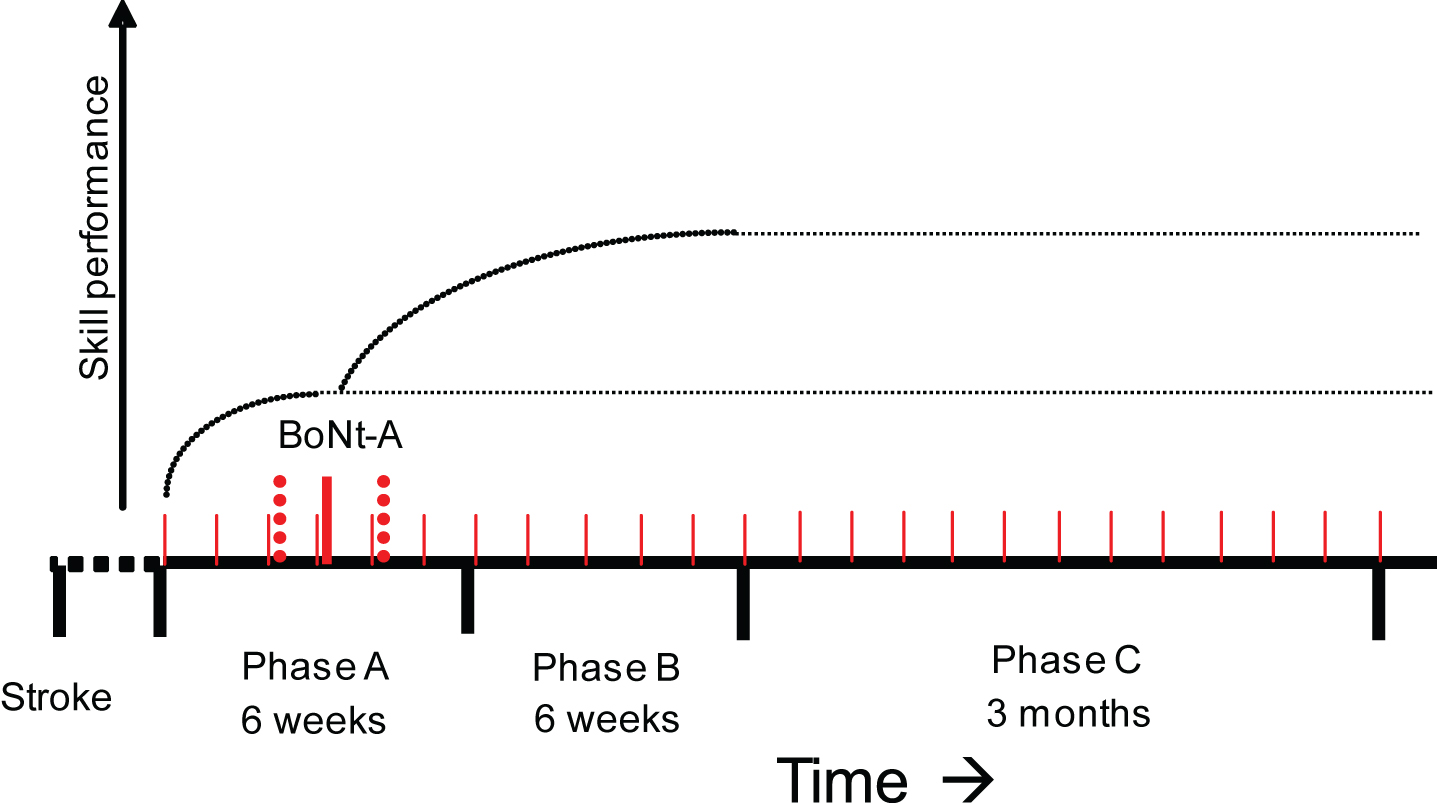 Schematic representation of the study design. ABoNt-A = application of ABoNt-A. Phase A = 3 - 6 weeks of training in CARAS, program 2. Phase B = CARAS training in program 2 after ABoNt-A injections. Phase C = Measurement moments from 2 till 12 weeks after CARAS. Dotted line: experimental stimulus or intervention. Dark dots: measurements of outcome variable X.
