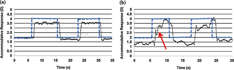 Dynamic accommodative trace in a normal subject (a) and an individual with mTBI (b) showing slowed dynamic trajectory (red arrow) in the latter subject. Blue dotted line indicates step change in the stimulus between the two target distances. Reprinted with permission from Green, 2009.