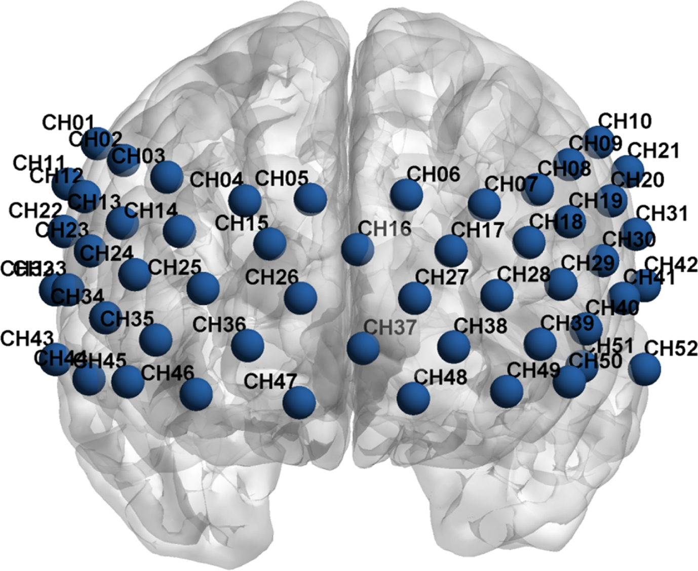 The placement of 52 channels following the Montreal Neurological Institute (MNI) coordinates.