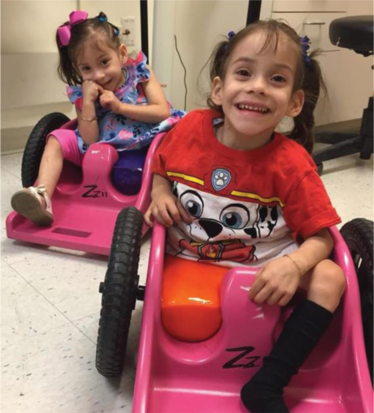 The twins received ZipZac chairs that were customized by Shriners with flexible, custom-formed foam to support each twin’s hemipelvis at midline as well as with parent push handles for use in the community. (Written photo consents obtained.).