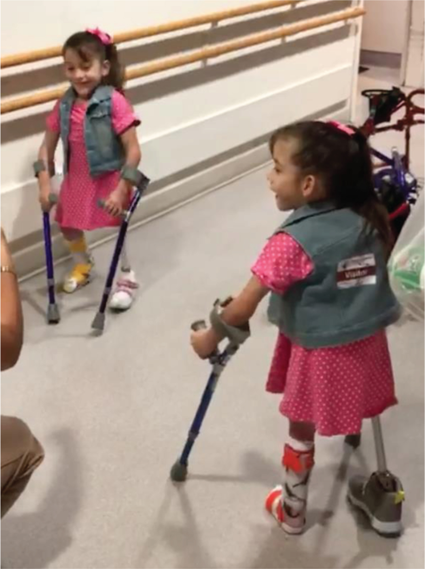 After several years with a walker, the twins progressed to using Lofstrand crutches. (Written photo consents obtained.).