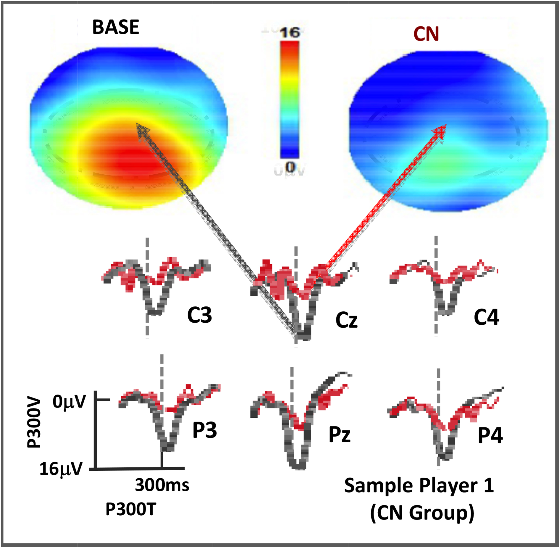 P300 rare tone depths for a player at BASE and CN displayed as topographs (top, with color scale as shown) and as voltage plots for the C-P region of interest (below, with black at BASE and red at CN). Vertical dotted lines are at 300msec post stimulus.