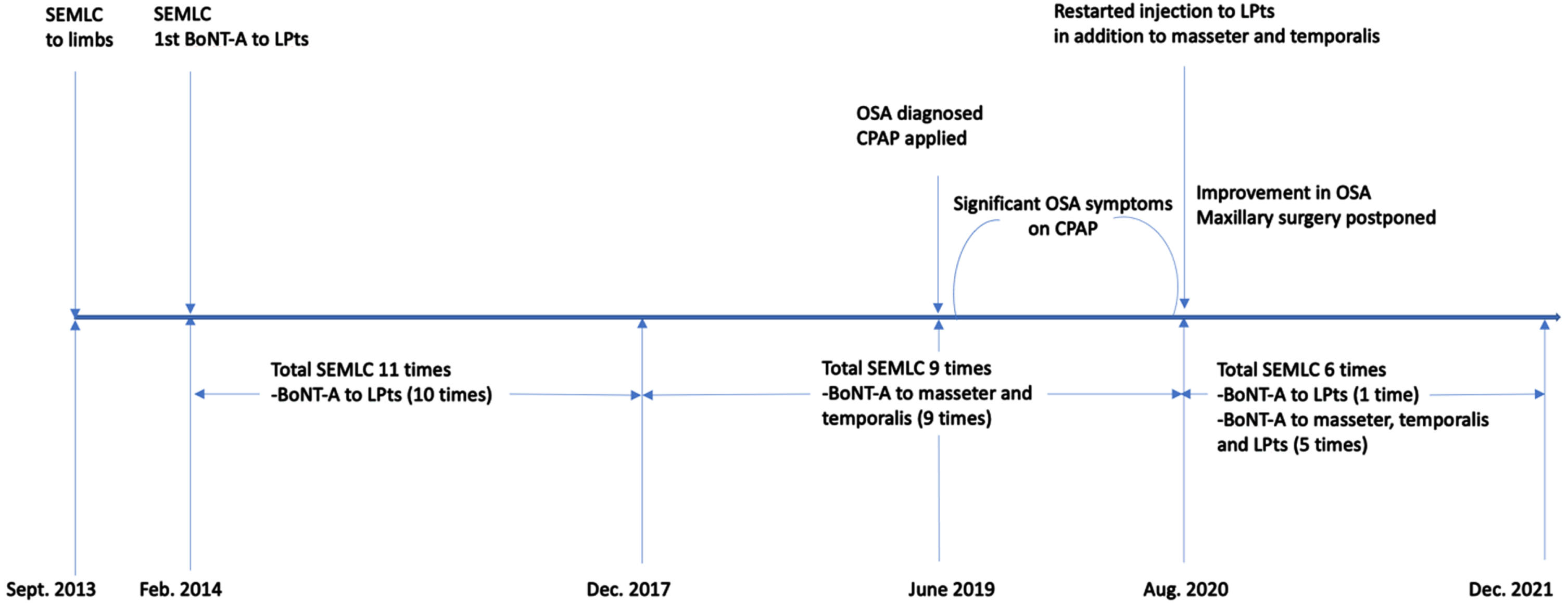 Timeline of chemodenervation. SEMLC: Single Event Multi-Level Chemoneurolysis; LPts: Lateral Pterygoids; BoNT-A: OnabotulinumtoxinA; OSA: Obstructive Sleep Apnea; CPAP: Continuous Positive Airway Pressure.