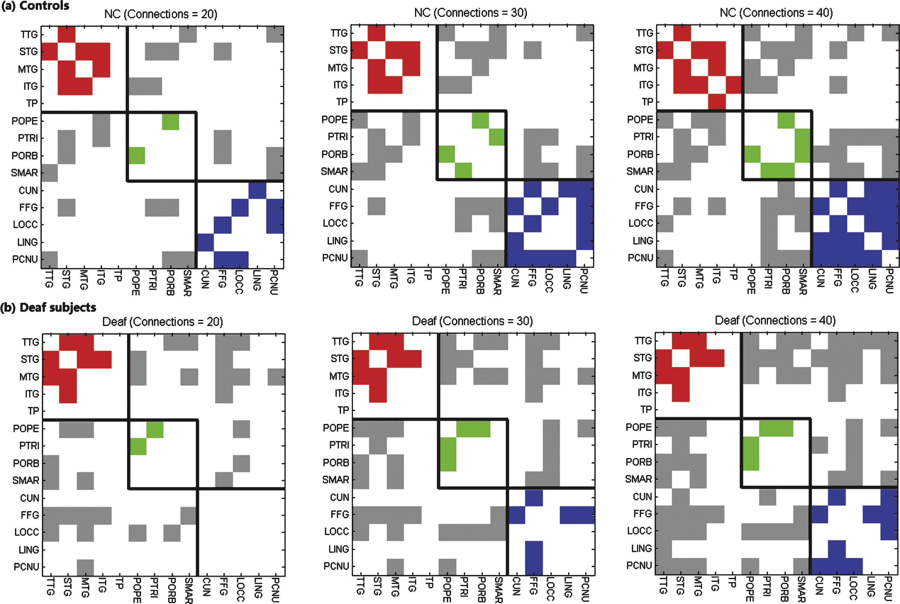 Binary matrices of grey matter connectivity with different sparsities (20, 30 and 40 connections over a total of 91 possible connections) for (a) normal controls and (b) deaf subjects respectively. The colors of red, green and blue indicate connections within auditory, language, and visual systems respectively, and the grey color represents connections between these systems. Black lines divide the 14 ROIs into auditory, language and visual systems accordingly.