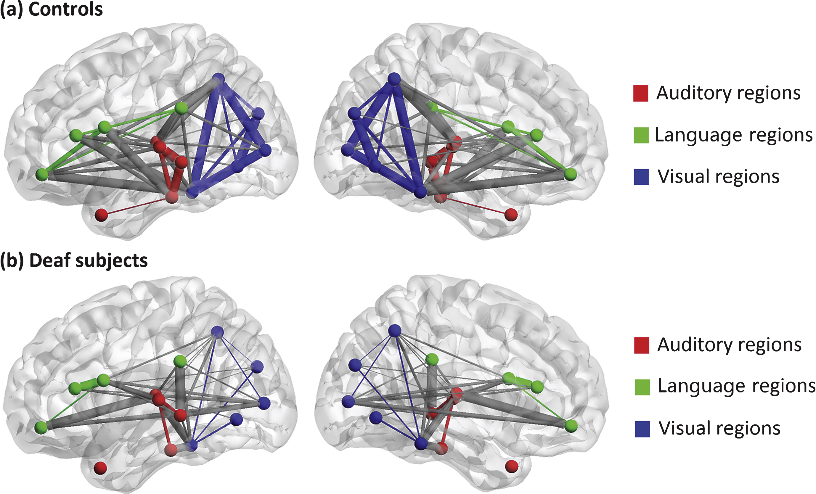 A 3D view of grey matter connectivity within and between auditory, language and visual systems in (a) normal controls and (b) deaf subjects. The lateral and medium views are shown. The nodes involved in auditory, language and visual processing are represented by red, green and blue respectively. The connections within each system are shown as the same color as the nodes, and the connections between these systems are present in grey color. Thicker edges indicate stronger connectivity, while thinner edges indicate weaker connectivity.