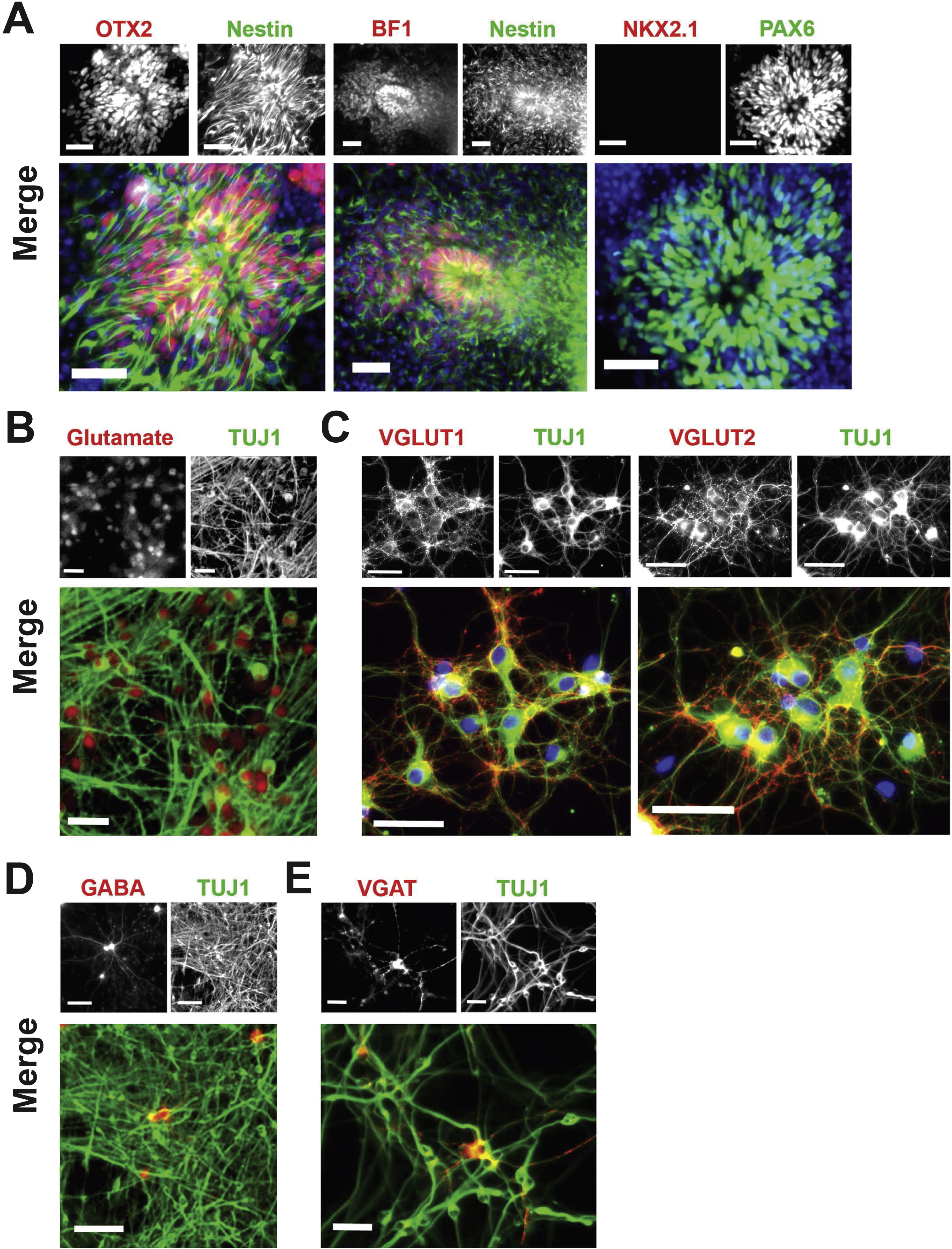 Neocortical differentiation. (A) Characterization of neocortical neuroepithelial rosettes derived from hPSCs on day 16 of differentiation. Nestin + rosettes (green) contain cells expressing the anterior telencephalic transcription factors OTX2 (red, left frame), BF1 (red, middle frame), and PAX6 (green, right frame). In contrast, the ventral telencephalic marker NKK2.1 (red, right frame) was not expressed. Nuclei are stained with DAPI (blue). Scale bar = 50μm. (B) Immunocytochemical staining for glutamate (red) and TUJ1 (green) on day 47 of differentiation using the current protocol, as shown in Fig. 1B. Scale bar = 25μm. (C) TUJ1 + neurons (green) were positive for the vesicular glutamate transporters VGLUT1 (red, left frame) and VGLUT2 (red, right frame) on day 47 of differentiation. Nuclei are stained with DAPI (blue). Scale bar = 50μm. (D) Expression of GABA (red) and TUJ1 (green) by immunocytochemistry on day 47 of differentiation. Scale bar = 100μm. (E) Expression of the GABA transporter VGAT (red) and TUJ1 (green) by immunocytochemistry on day 47 of differentiation. Scale bar = 25μm. Cell line: ES04.
