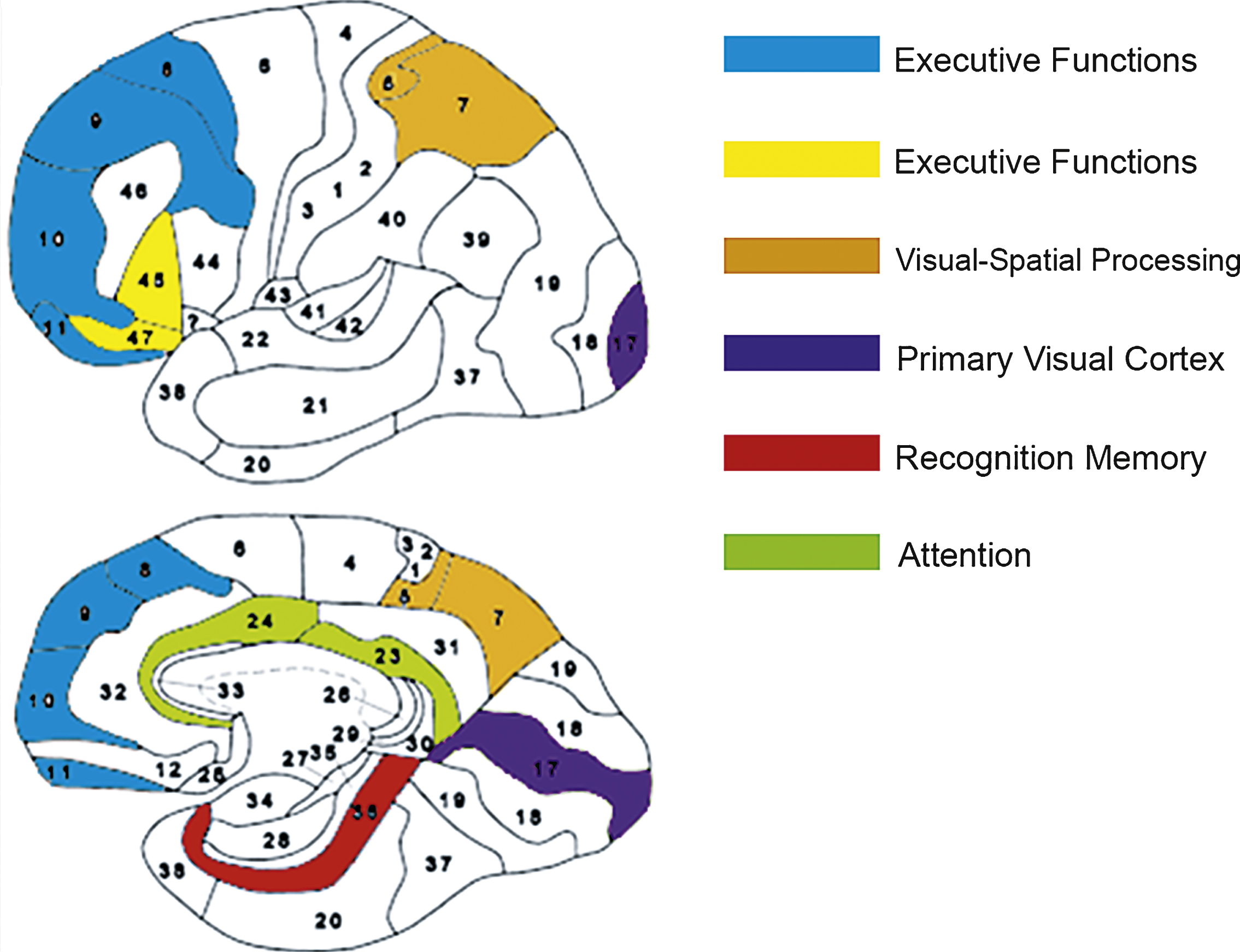 The Brodmann areas that were most improved after HBO2; perirhinal cortex (BA36) in red, the pre-frontal cortex (BA 8,9,10,11) in blue, inferior frontal gyrus (BA 45,47) in yellow, the anterior cingulate gyrus (BA 23,24) in green, primary visual cortex (BA 17) in purple and the parietal lobes (BA 5,7) in orange.