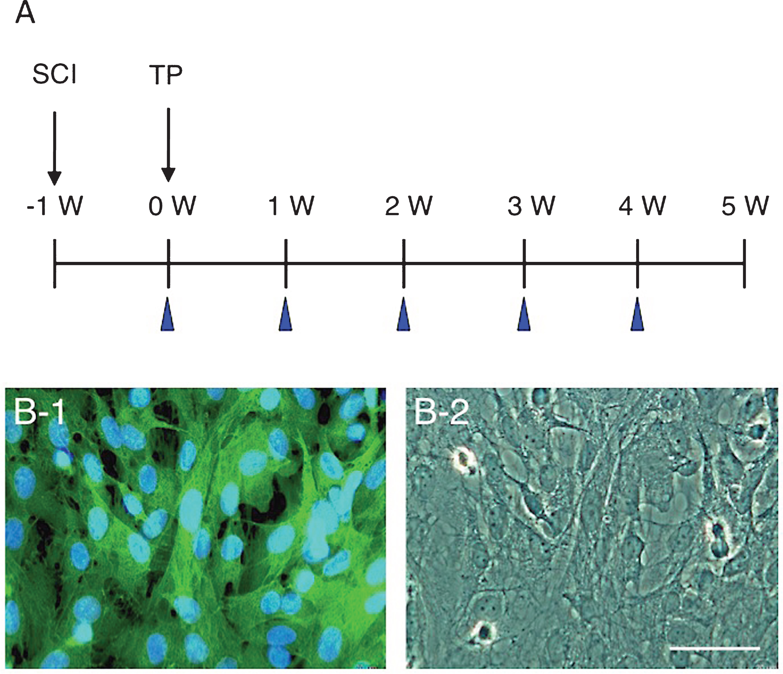A: The time course of surgery and cell transplantation. Cell transplantation (TP) was performed 1 week after spinal cord injury (SCI). BBB scores were evaluated at the time points indicated with arrowheads. B: All CPECs cultured from GFP-transgenic rats are green-fluorescent (B-1). The same region is shown by phase-contrast microscopy (B-2). Scale: 50 μm for B-1 and B-2.