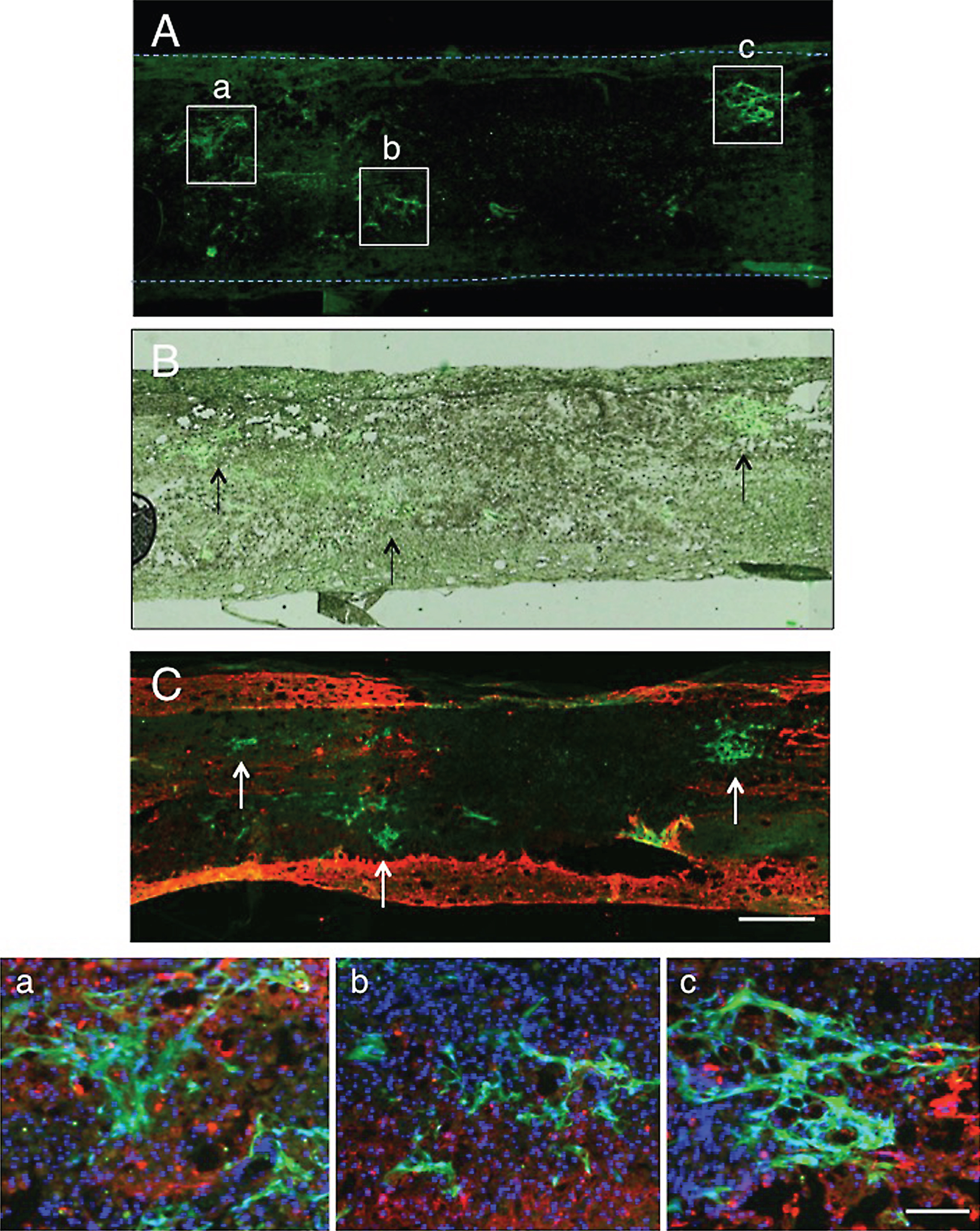 Localization of CPECs in the spinal cord lesion 2 days after transplantation. A: This fluorescent micrograph shows the presence of clusters of CPECs in the spinal cord lesion. Three large CPEC clusters are shown with rectangles (a-c). The dotted lines indicate the contour of the spinal cord. B: An unstained transmitted-light micrograph was merged in the fluorescent micrograph of panel A to show the localization of transplanted CPECs in the spinal cord tissue. Arrows point to clusters of CPECs corresponding to those shown in rectangles in panel A. C: GFAP immunostaining for astrocytes (red). This section was at the level a few sections away from that of panel A. Green-fluorescent CPEC clusters (some of them are pointed out with arrows) are located partly in association with astrocytes at the border of the lesion. No astrocytes can be seen within the lesion. a-c: The clusters of CPECs enclosed with rectangles (a-c) in panel A were enlarged to show the association with astrocytes. CPECs are partly associated with astrocytes at the border of the lesion (red). Cell nuclei were stained blue by DAPI staining. Scale: 500 μm for A- C, and 100 μm for a-c.
