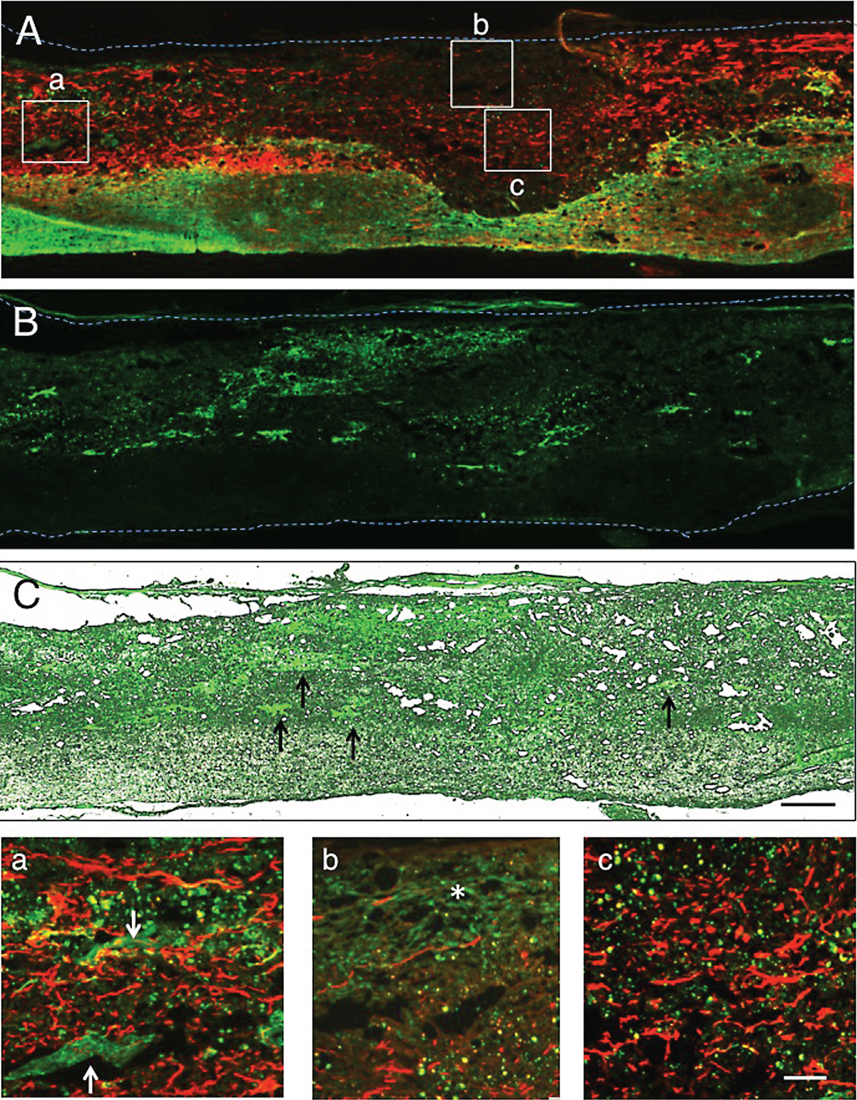 1 w-TP. Double staining for axons and astrocytes. A: The spinal cord was immunostained for axons (red) and astrocytes (green). The dotted line outlines the spinal cord. Numerous axons extend through the astrocyte-devoid areas (upper half of the spinal cord) in the spinal cord lesion. B: This simple fluorescent micrograph was taken from a section adjacent to that of panel A, showing various-sized clusters of engrafted CPECs. C: Panel B was merged in the unstained transmitted-light picture to show the localization of engrafted CPECs in the spinal cord tissue. Arrows point to some CPEC clusters. a: Rectangle a in panel A was enlarged. Some CPECs (arrows) can be seen among axons. b: Rectangle b in panel A was enlarged. Axons are scarce around the stacked CPECs (green, asterisk). c: Rectangle c in panel A was enlarged. Many axons extend without an association with engrafted CPECs. Scale: 500 μm for A-C, and 100 μm for a-c.