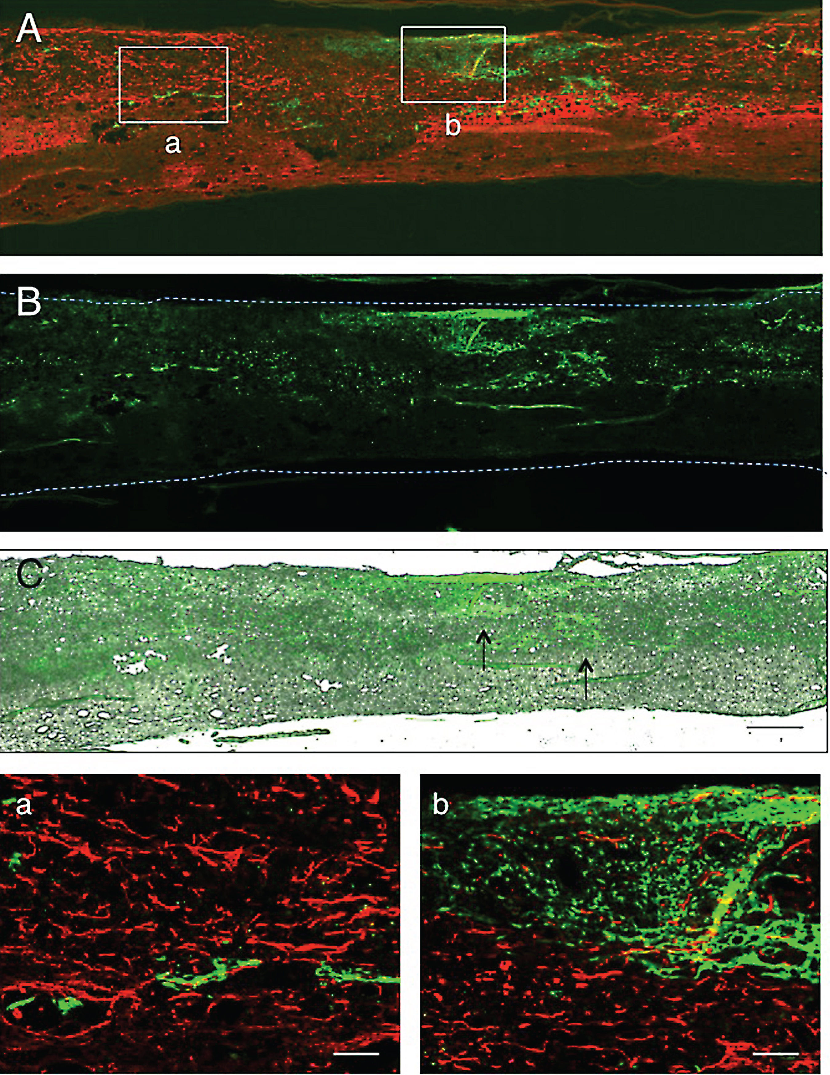1 w-TP. Immunostaining for axons. The spinal cord was immunostained for axons. This micrograph was at a level several sections away from that of Fig. 4. A: Axons (red) are found in the remaining host spinal cord tissue and the astrocyte-devoid areas shown in Fig. 4A. CPEC clusters of various sizes (green) are located within and at the border of the lesion. B: This simple fluorescent micrograph was taken from a section adjacent to that of panel A, showing clusters of engrafted CPECs. C: Panel B was merged in the unstained transmitted-light picture to show the localization of engrafted CPECs in the spinal cord tissue. Arrows point to some of the clusters. a: Rectangle a in panel A was enlarged. Small clusters of CPECs (green) can be seen among axons that have various diameters and irregular orientations. b: Rectangle b in panel A was enlarged. Axons are scarce around and within the stacked CPECs (green). Scale: 500 μm for A-C, and 100 μm for a and b.