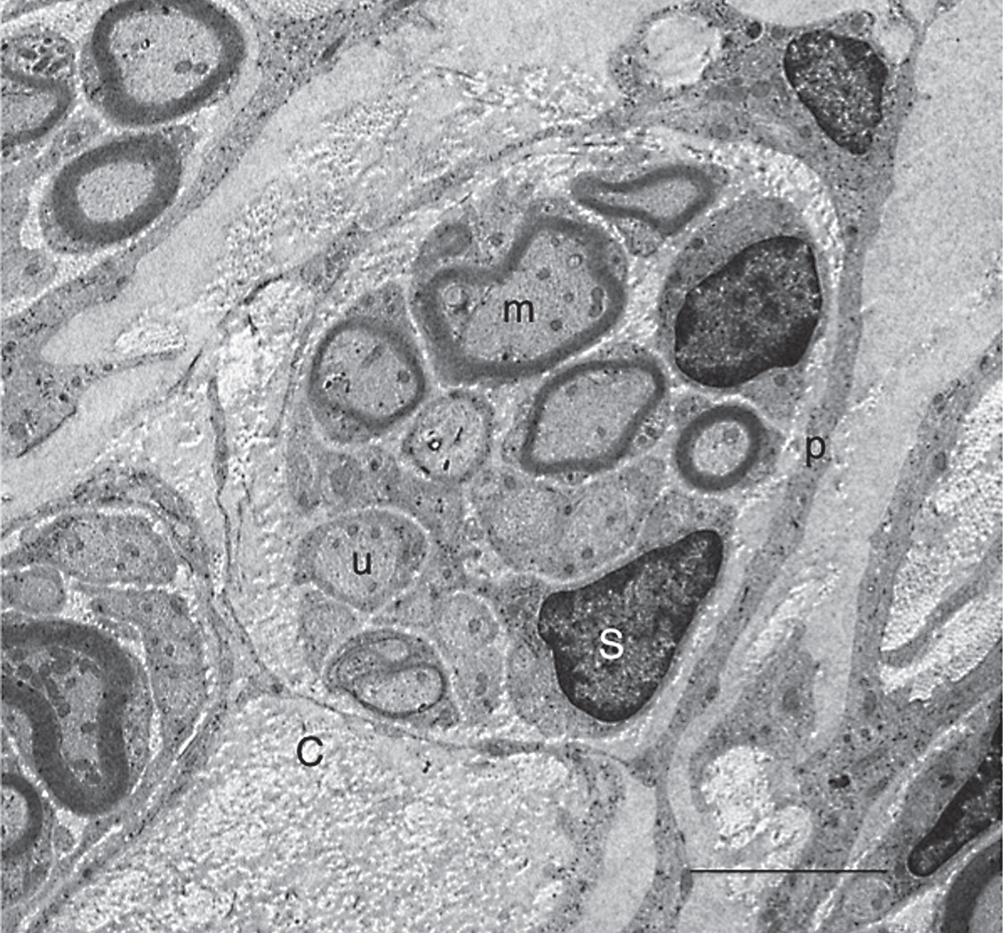 Conventional electron microscopy of axons in the astrocyte-devoid areas. 5 w-TP. This electron micrograph was taken from the astrocyte-devoid area of the spinal cord at 5 w-TP. Myelinated (m) and unmyelinated (u) axons are bundled, and surrounded by perineural sheaths (p). Axons are associated with Schwann cells (S). All these cellular components are embedded in the collagen fibril matrices (C). Scale: 5 μm.