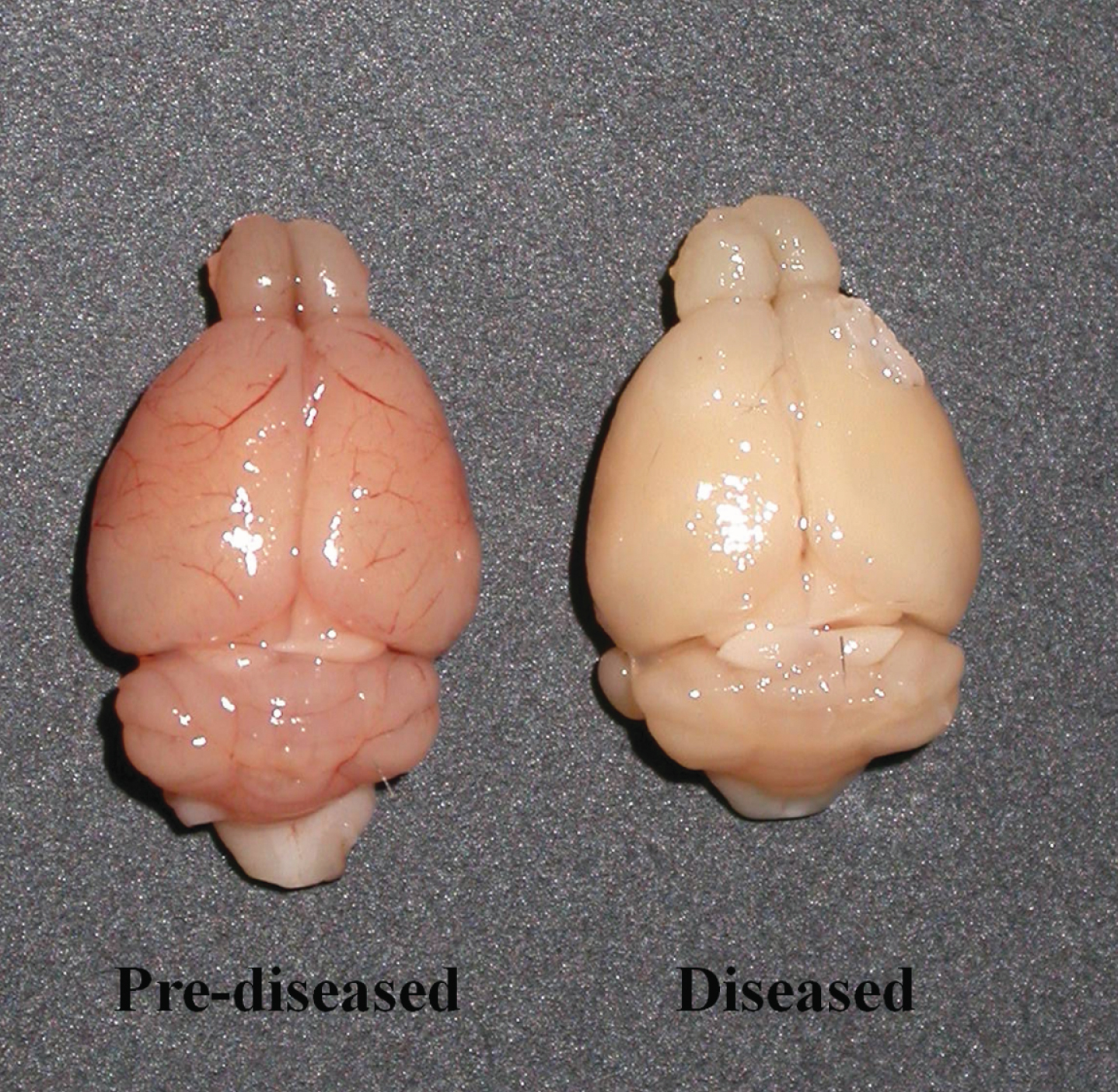 Unfixed and non-perfused brains of the pre-diseased mice and the diseased mice. Photograph showing the brains of the pre-diseased mice (left) and the diseased mice (right).