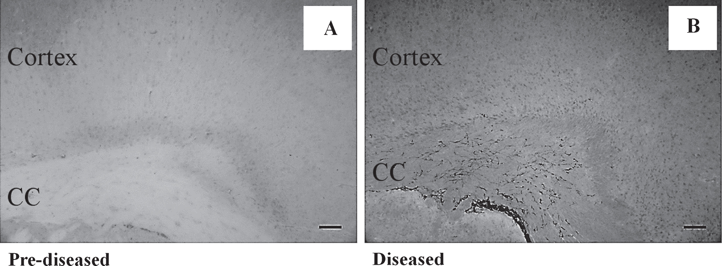 No DCX+ cell was found in the cortex of the pre-diseased mice and the diseased mice Representative images showing no DCX+ cell was found in the cortex of (A) the pre-diseased mice and (B) the diseased mice; scale bar: 100 μm.