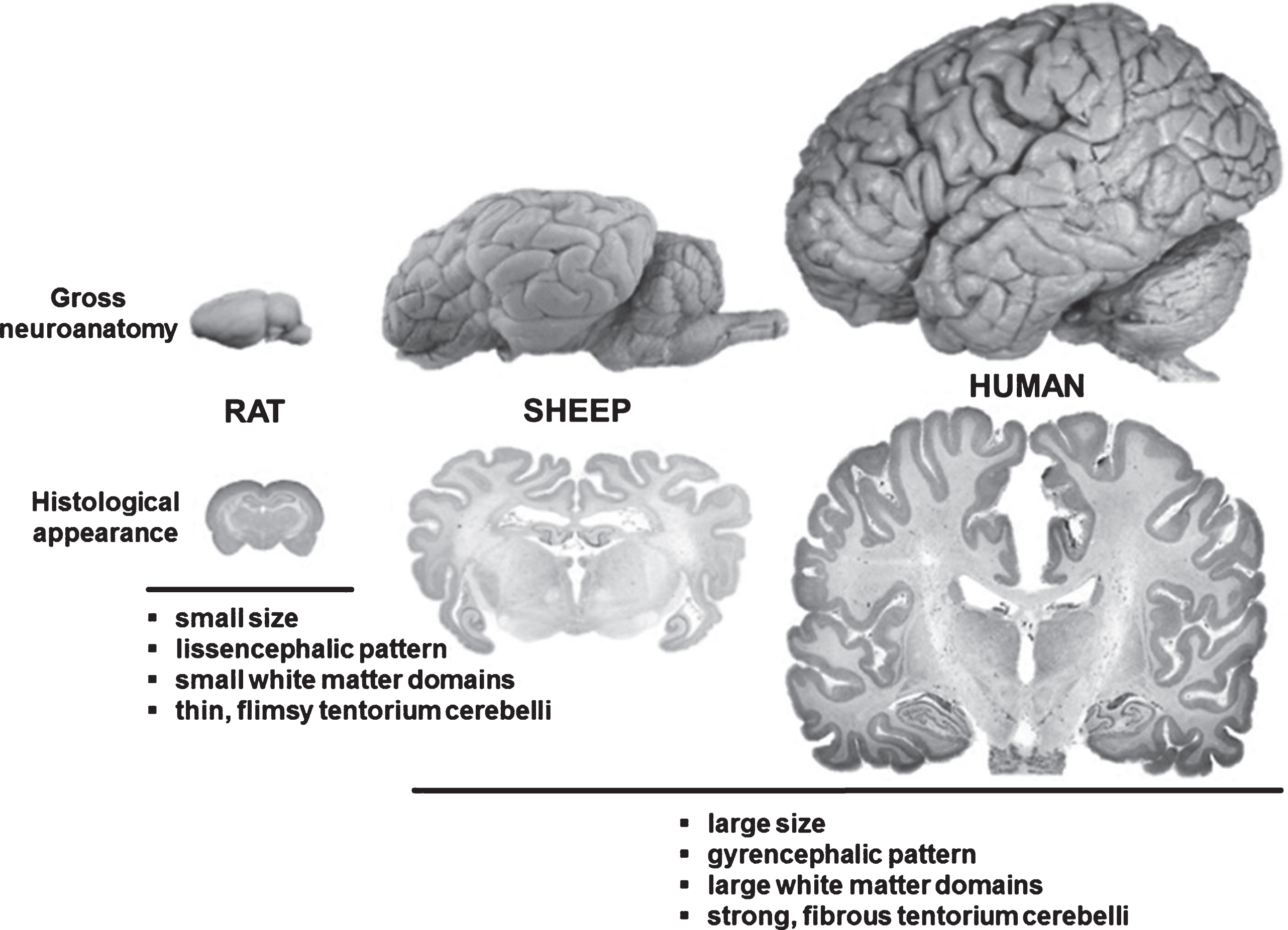 Comparison between rodent, ovine and human brain. Although significantly smaller than the human brain, the ovine brain is also gyrencephalic and exhibits a grey-to-white-matter ration more similar to humans as compared to the rodent brains. Sheep are therefore considered an interesting model species for translational neuroscience.