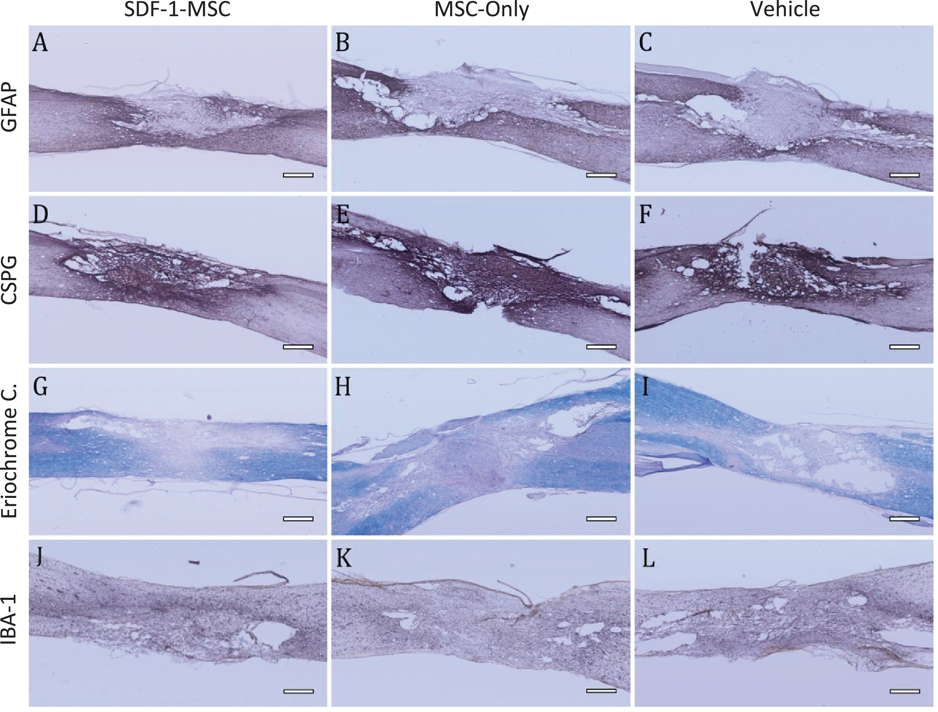 Immunohistochemistry GFAP, CSPG, Eriochrome Cyanine, IBA-1. (A-I) Immunohistology was performed to analyze major histopathological outcomes for astrocytes as measured by GFAP (A-C), for proteoglycans as measured by CSPG (D-F), for white matter pathology as measured by eriochrome cyanine staining (G-I), and for inflammation as measured by IBA-1 (J-L). No significant differences could be detected between SDF-1-MSC (A,D,G,J), MSC-only (B,E,H,K), or vehicle (C,F,I,L) groups. Areas of the lesions can be identified by clear boundaries in CSPG and GFAP labeling. Tissue within the lesion area is void of immunological labeling for GFAP, but dense in CSPG labeling. Scale bars represent 500-μm.