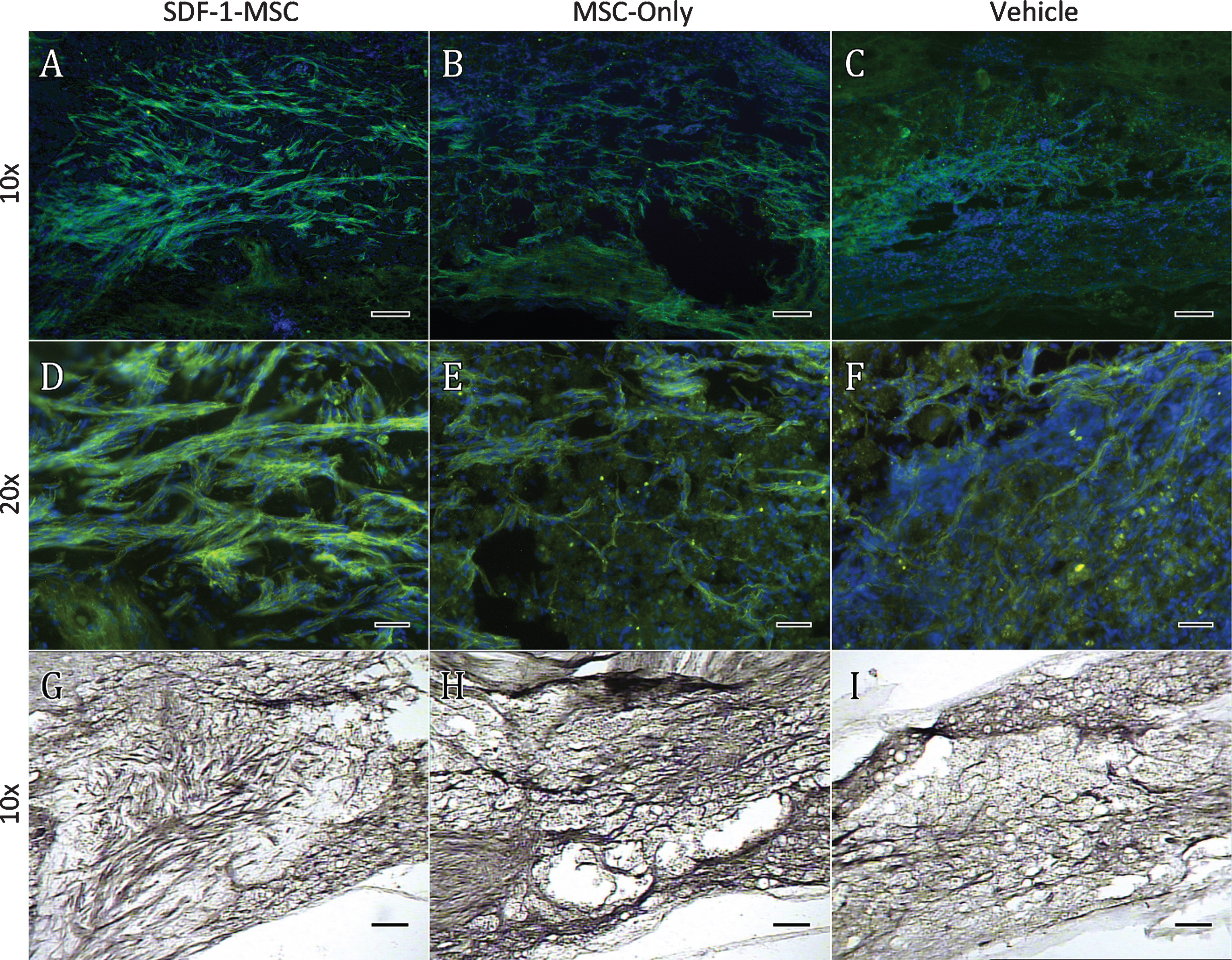 Immunohistochemistry GAP-43. GAP-43 immunological labeling was found to be significantly increased within the lesion cores for SDF-1-MSC-treated (A,D,G), but not in MSC-only rats (B,E,H) compared to vehicle-treated controls (C,F,I). Data was quantified using DAB labeling (G-I) by tracing lesion cores and obtaining optical densitometry measurements using Image J. Fluorescent microscopy was utilized for imaging to confirm the specificity and localization of labeling (A-F). A 10x objective (A-C, G-I) revealed GAP-43 labeling predominately within the lesion center, while images taken with 20x objectives (D-F) revealed individual fibers or fiber bundles. Scale bars represent 100-μm (A-C, G-I) and 50-μm (D-E).