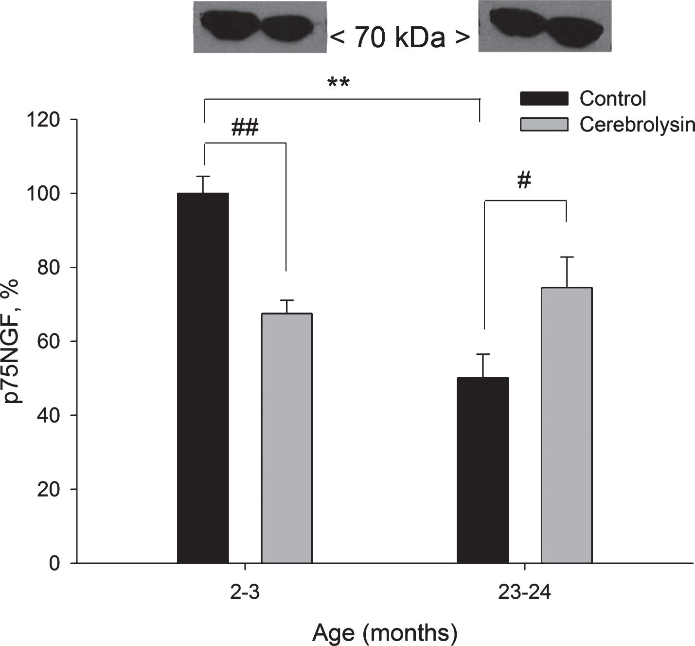 Effect of CBL on p75NGF expression in the neocortex of young and old rats. Vehicle (n = 7–8 per group), CBL (n = 7–8). Data are presented as M±S.E.M. **- p < 0.01 versus respective young group; #, ## - p < 0.05 and p < 0.01, respectively, versus respective age control, Mann-Whitney U-test.