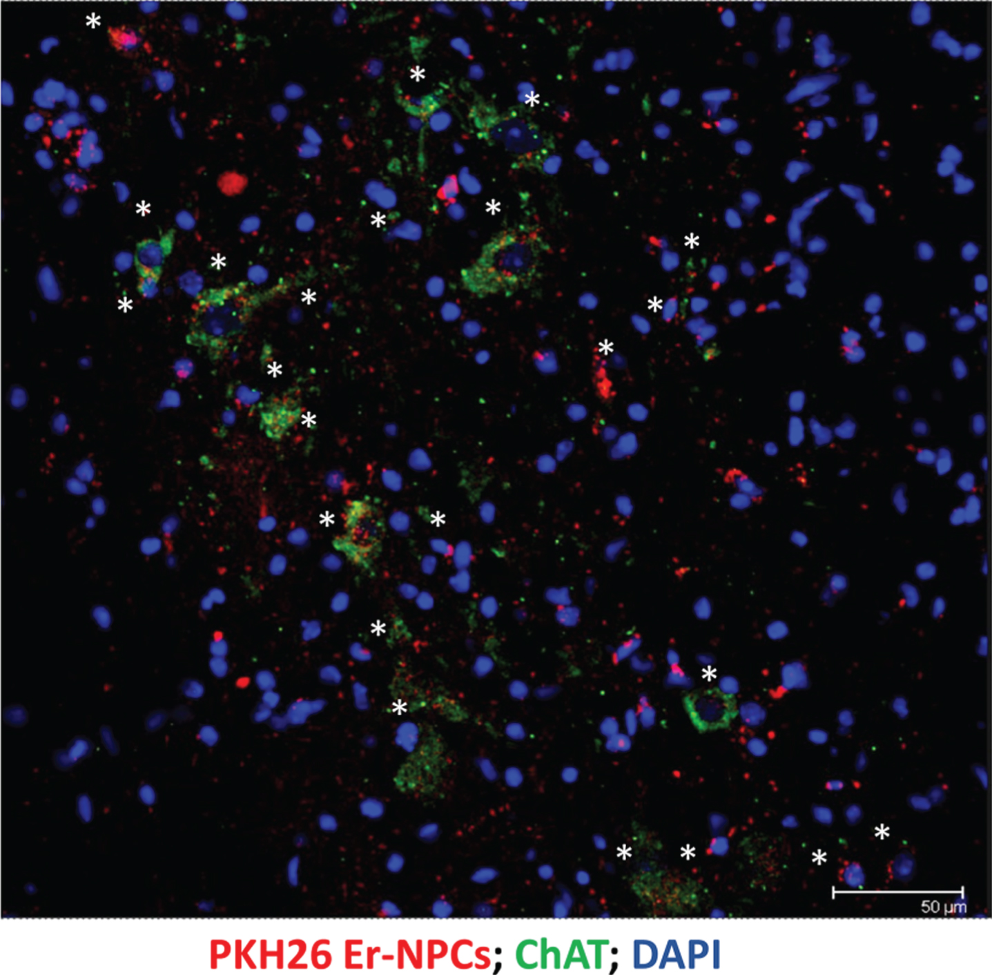Er-NPCs transplanted cells differentiate into cholinergic neurons. At 30 days after i.v. injection, several PKH26-labeled Er-NPCs (red) were accumulated at the edges of the lesion. Most Er-NPCs were positive for ChAT immunostaining (green; stars) (Scale bar = 50 μm).