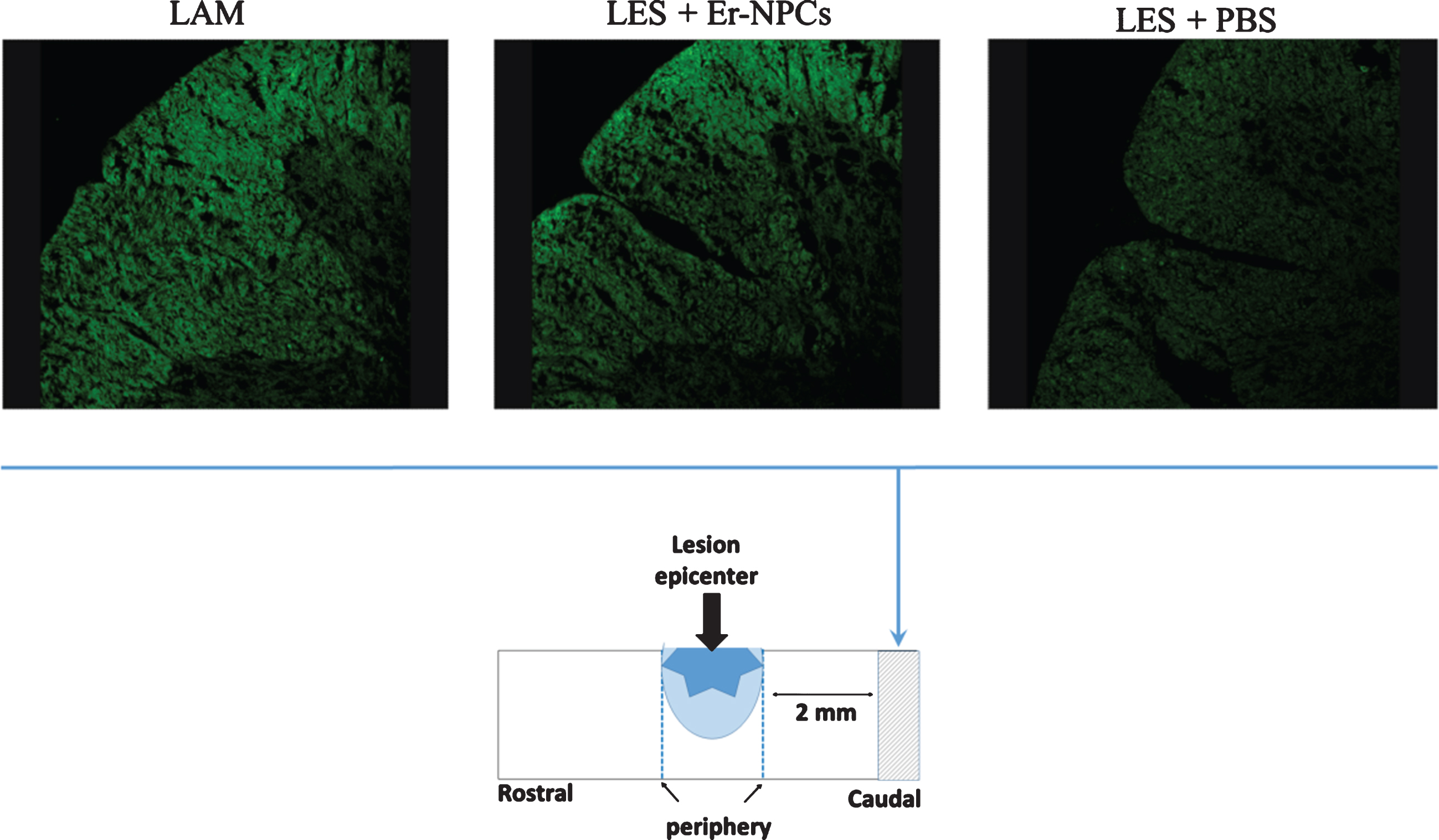 Myelin preservation in the injured cord of animals treated with Er-NPCs. Myelin preservation was evaluated by means of Fluoromyelin™ staining (green) performed in sections at the lesion epicenter, and 2 mm caudally to the lesion site (please see schematic representation).